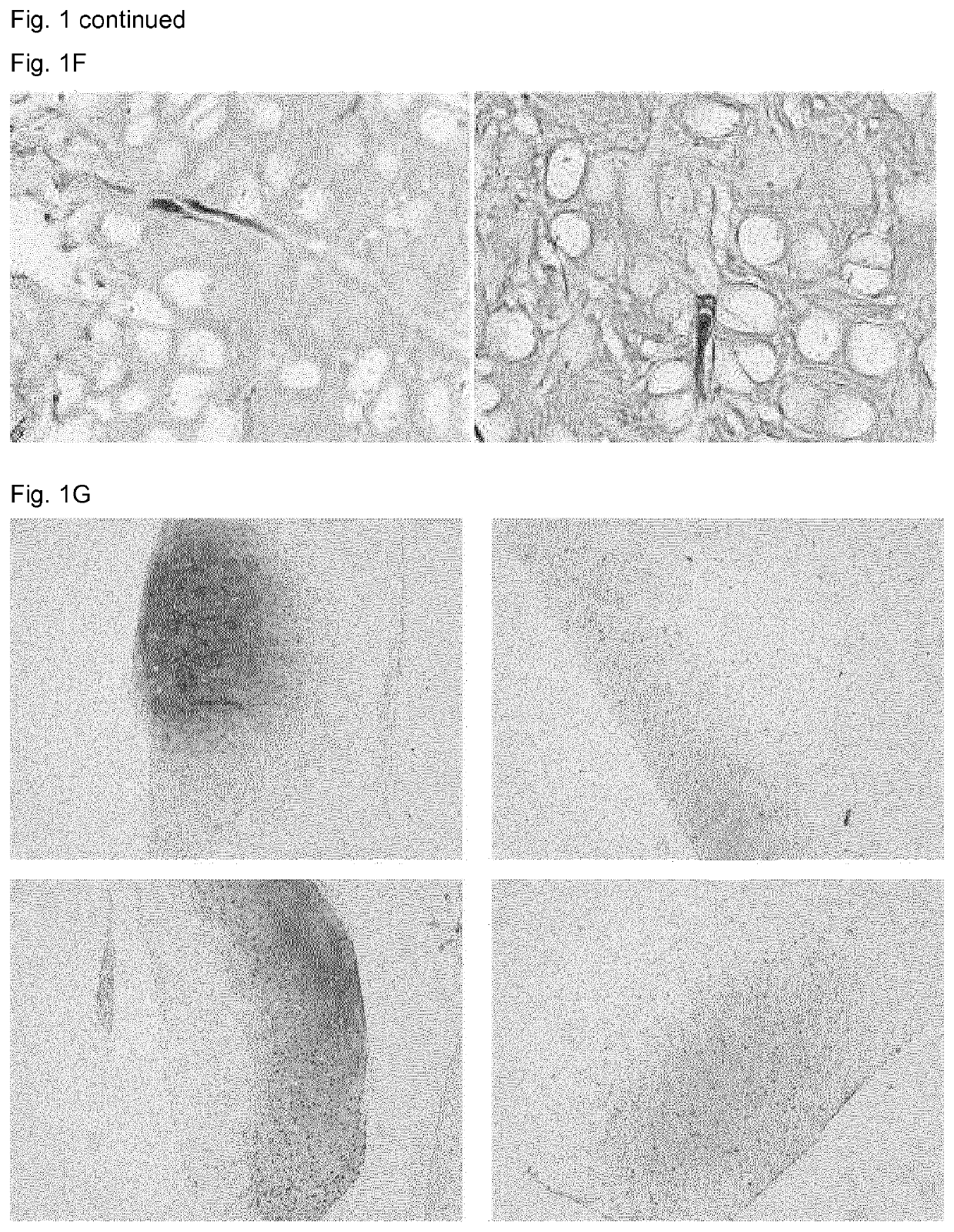 Elastin reduction allowing recellularization of cartilage implants