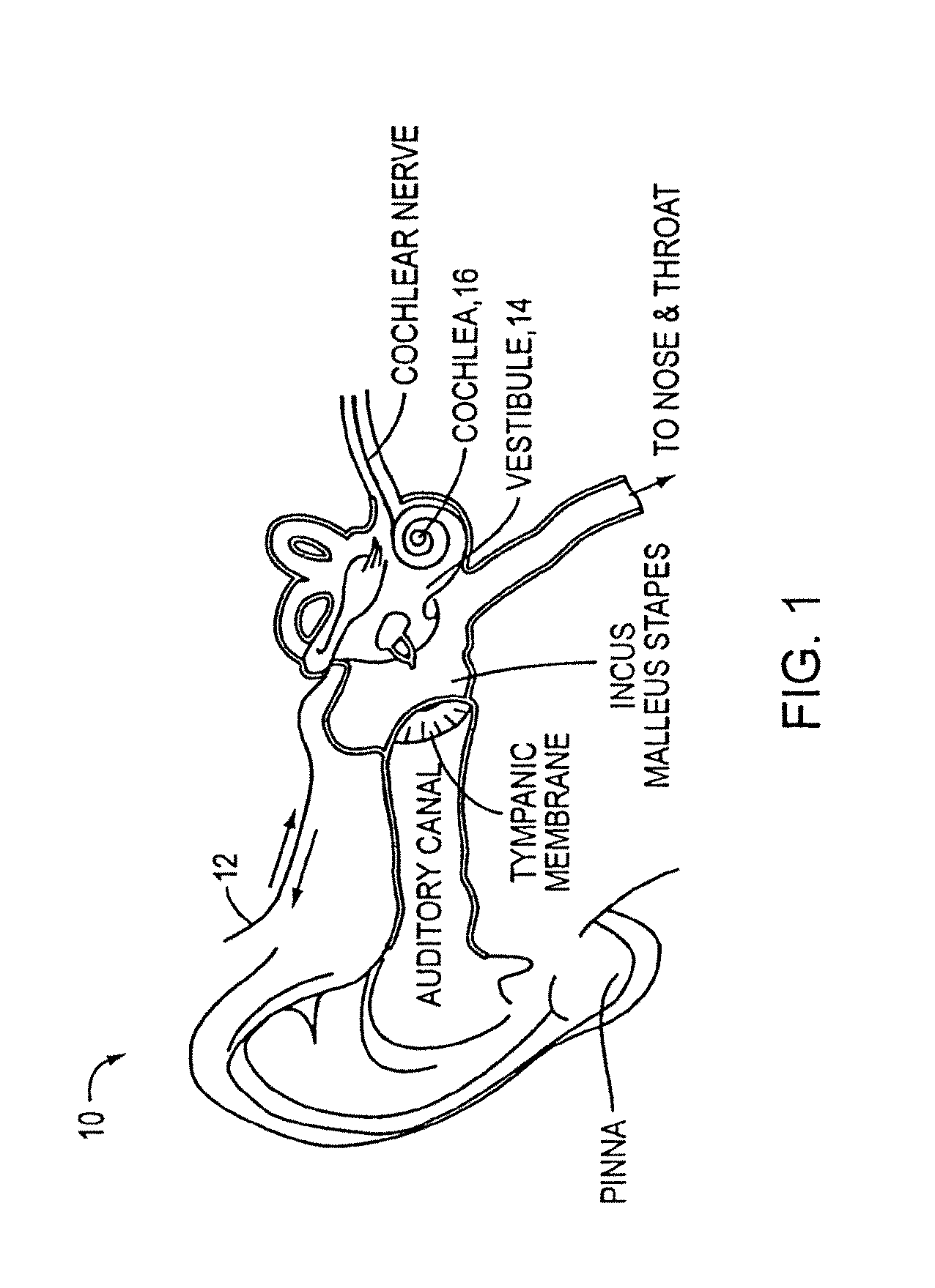 Drug delivery apparatus