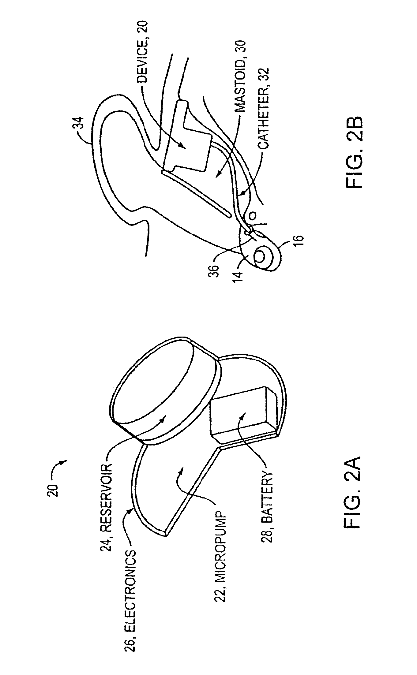 Drug delivery apparatus