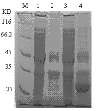 cDNA sequence and amino acid sequence of lugworm fibrinolytic enzyme with thrombolysis activity