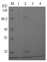 cDNA sequence and amino acid sequence of lugworm fibrinolytic enzyme with thrombolysis activity