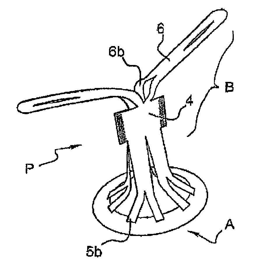 Hernia prosthesis and method for fabricating same