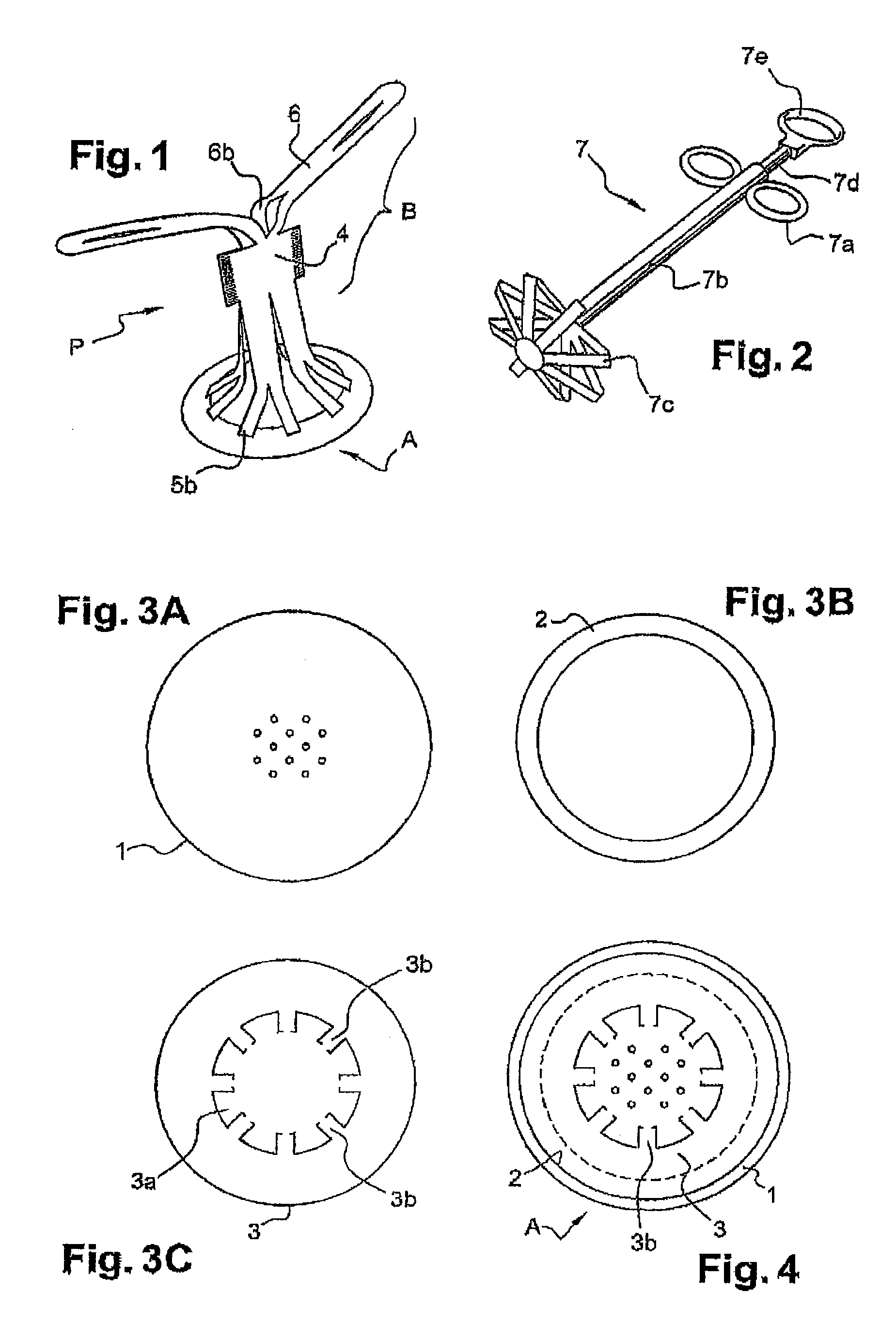 Hernia prosthesis and method for fabricating same