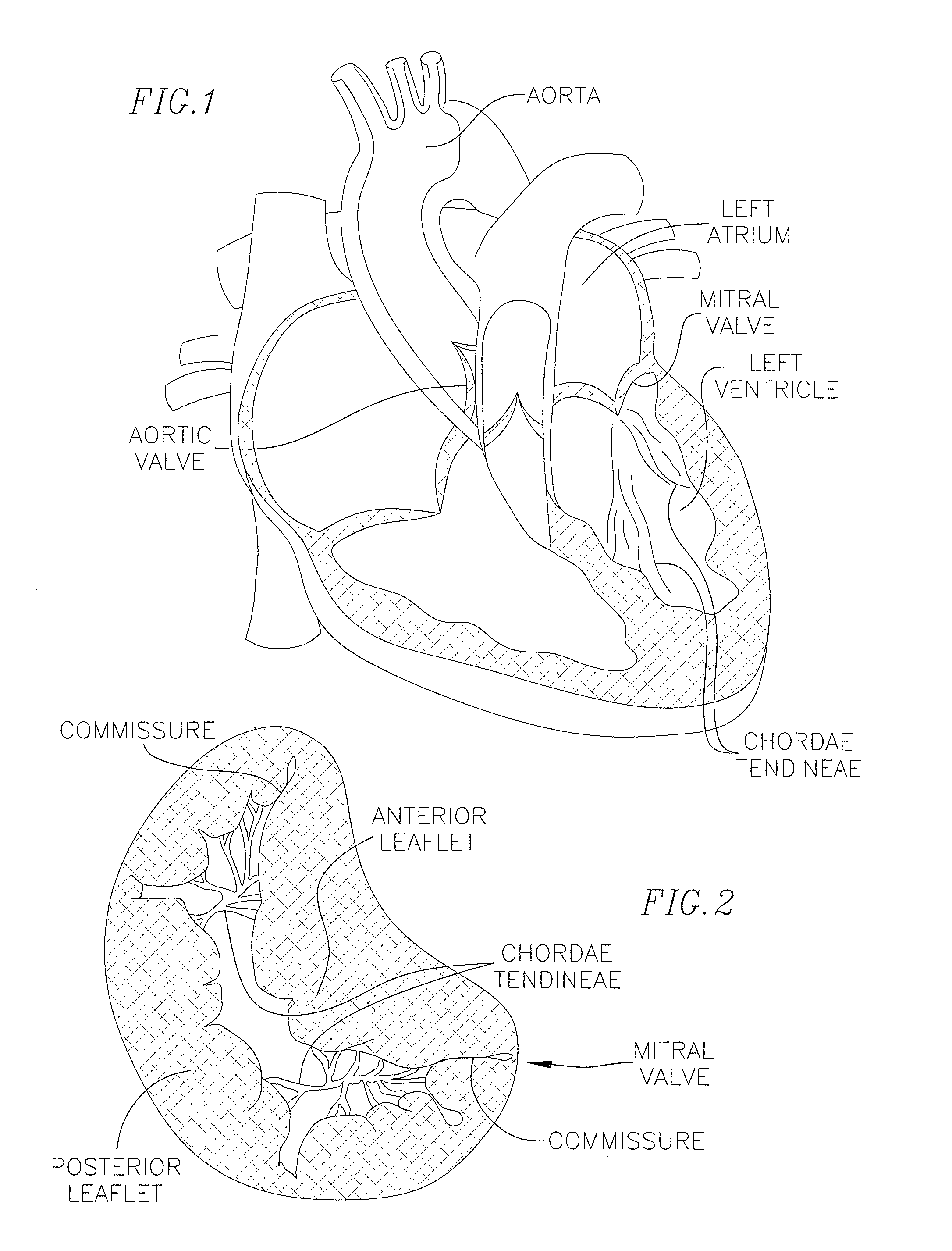 Coiled anchor for supporting prosthetic heart valve, prosthetic heart valve, and deployment device