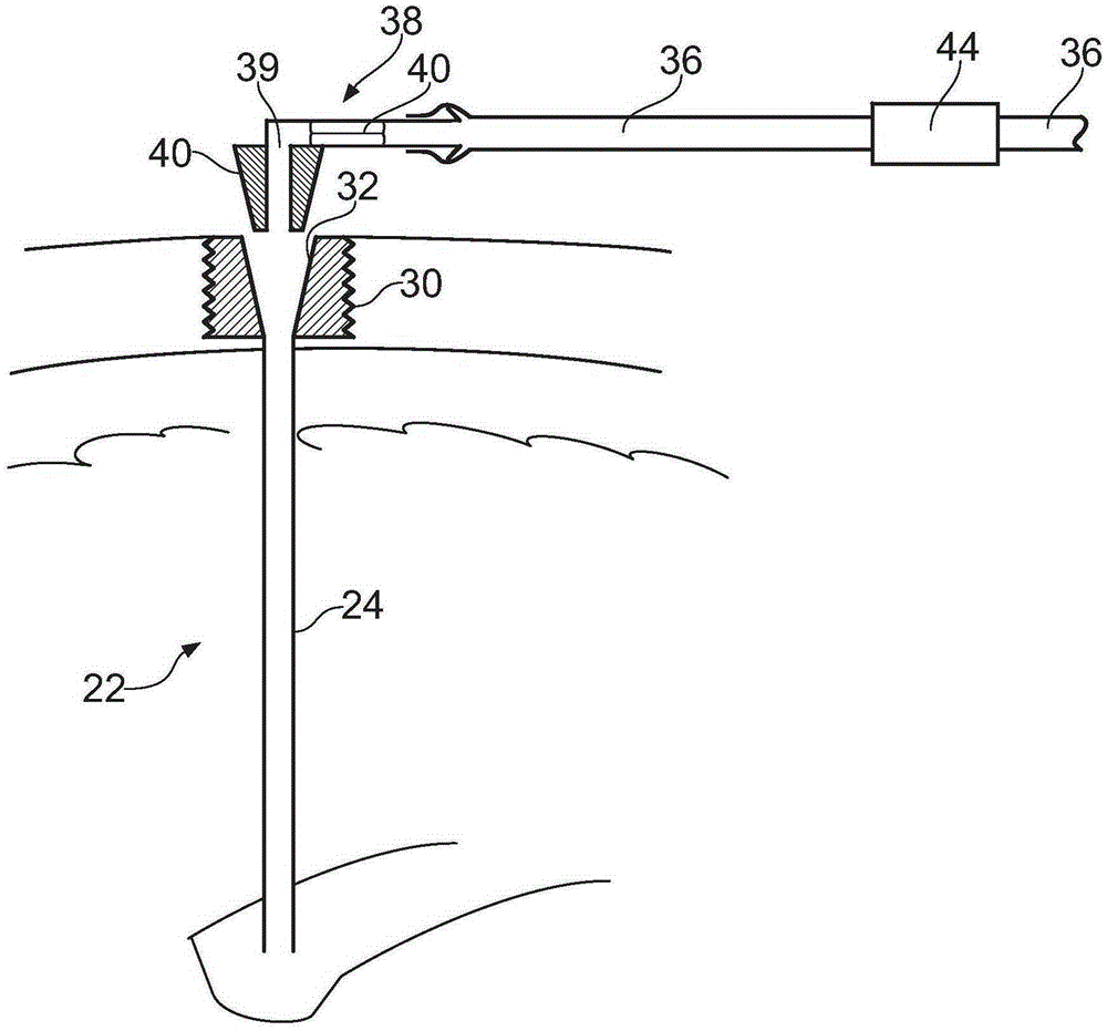 neurosurgical equipment