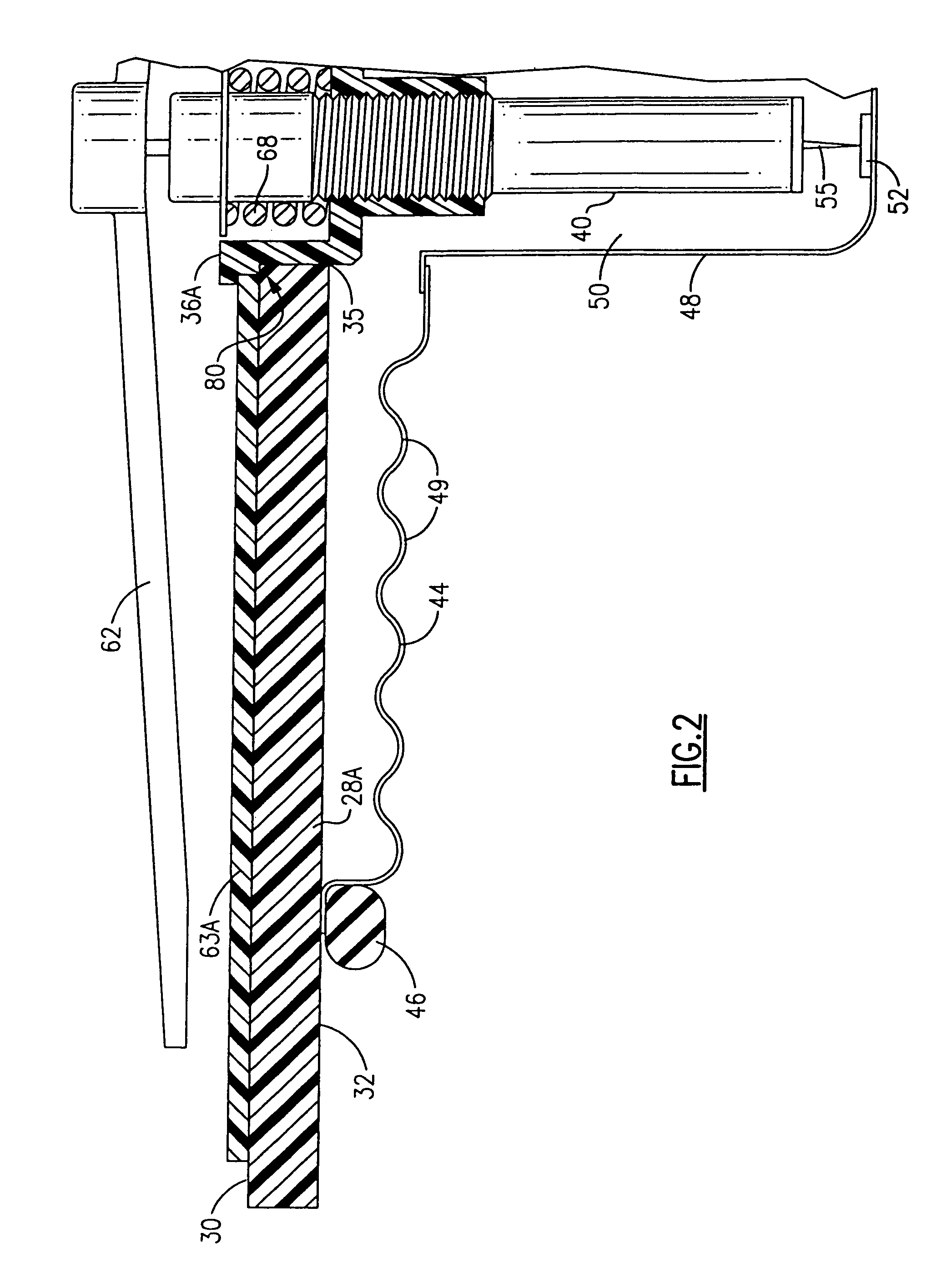 Blood pressure measuring apparatus