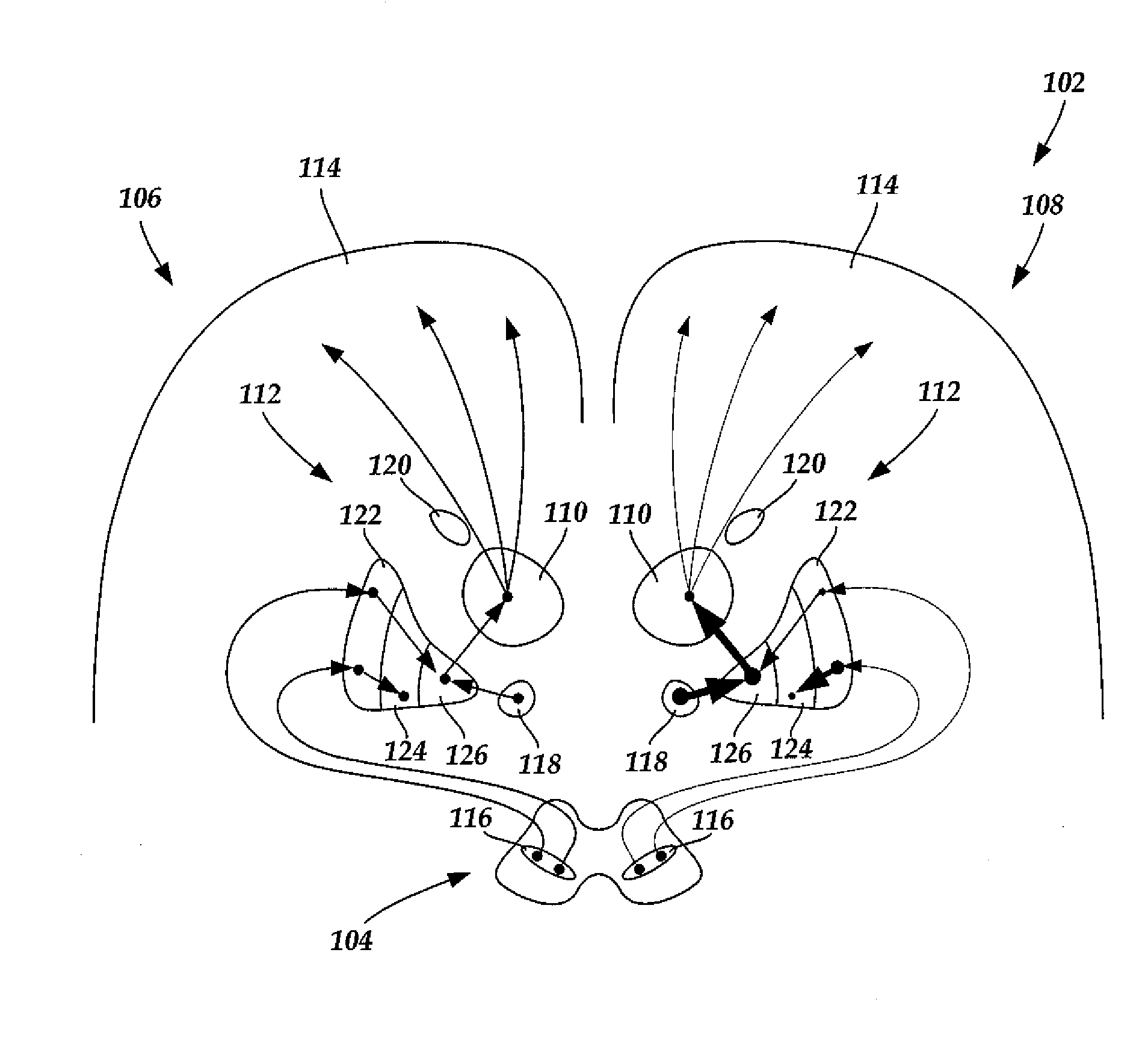 Systems and Methods for Treating Essential Tremor or Restless Leg Syndrome Using Spinal Cord Stimulation