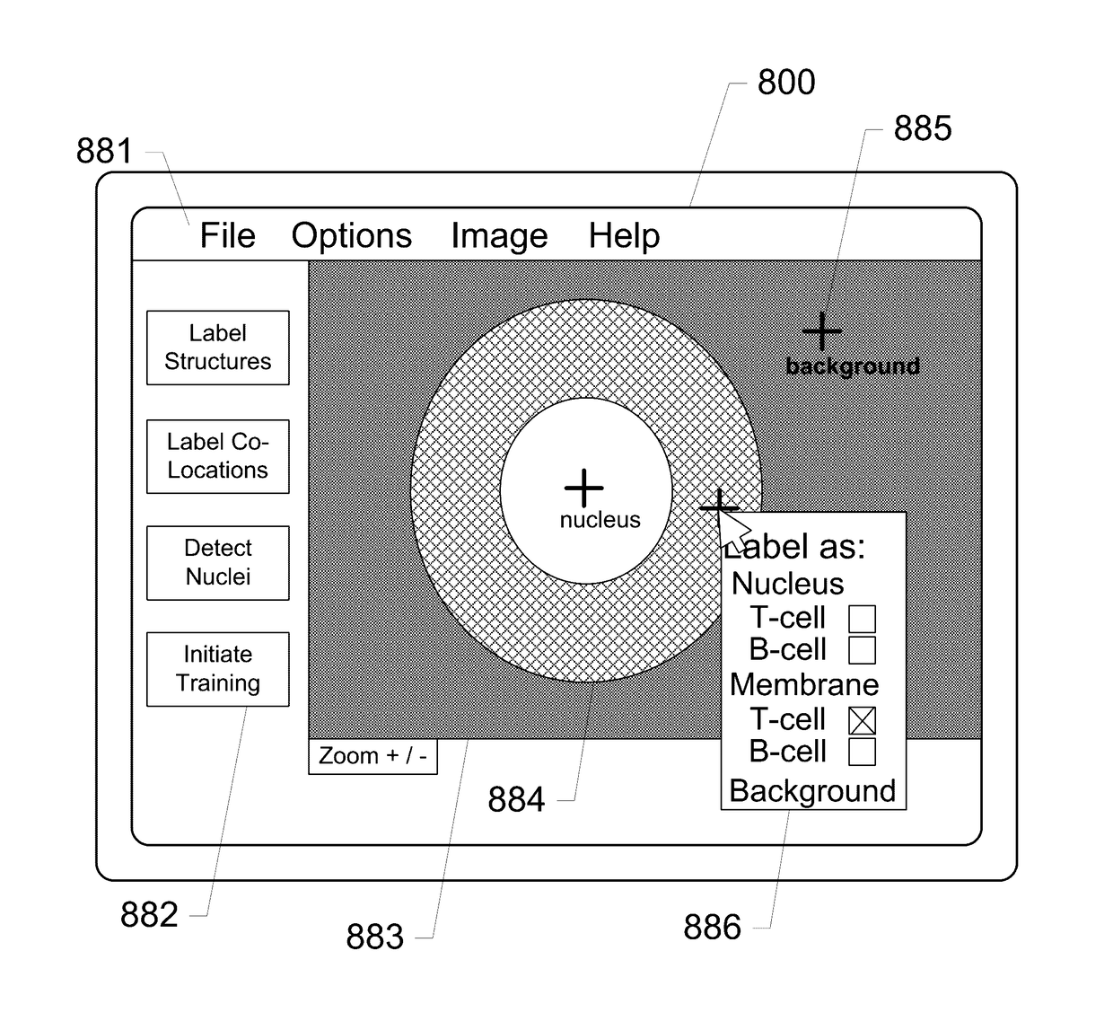 Systems and methods for detection of structures and/or patterns in images