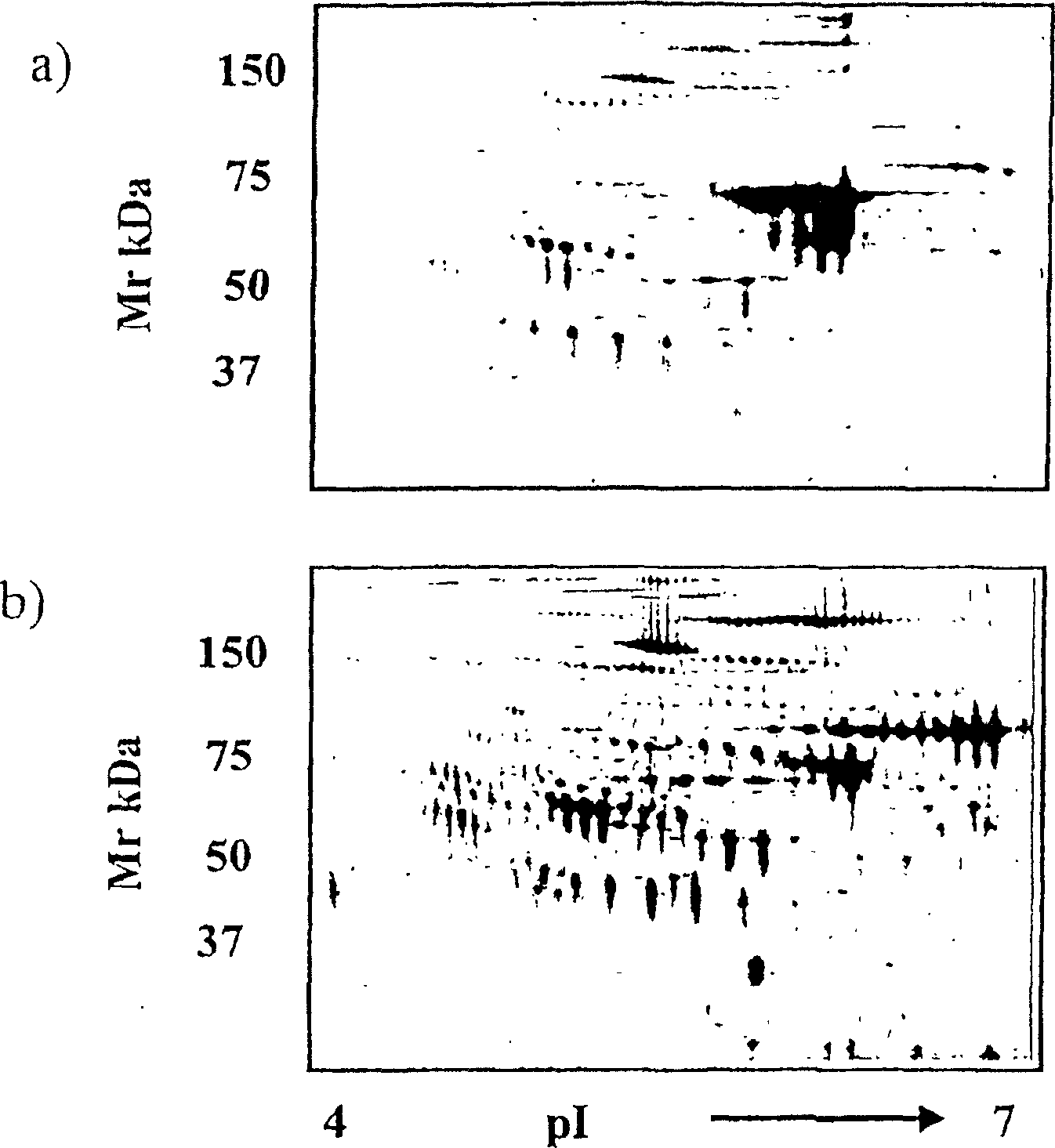 Diagnostic marker for ovarian cancer