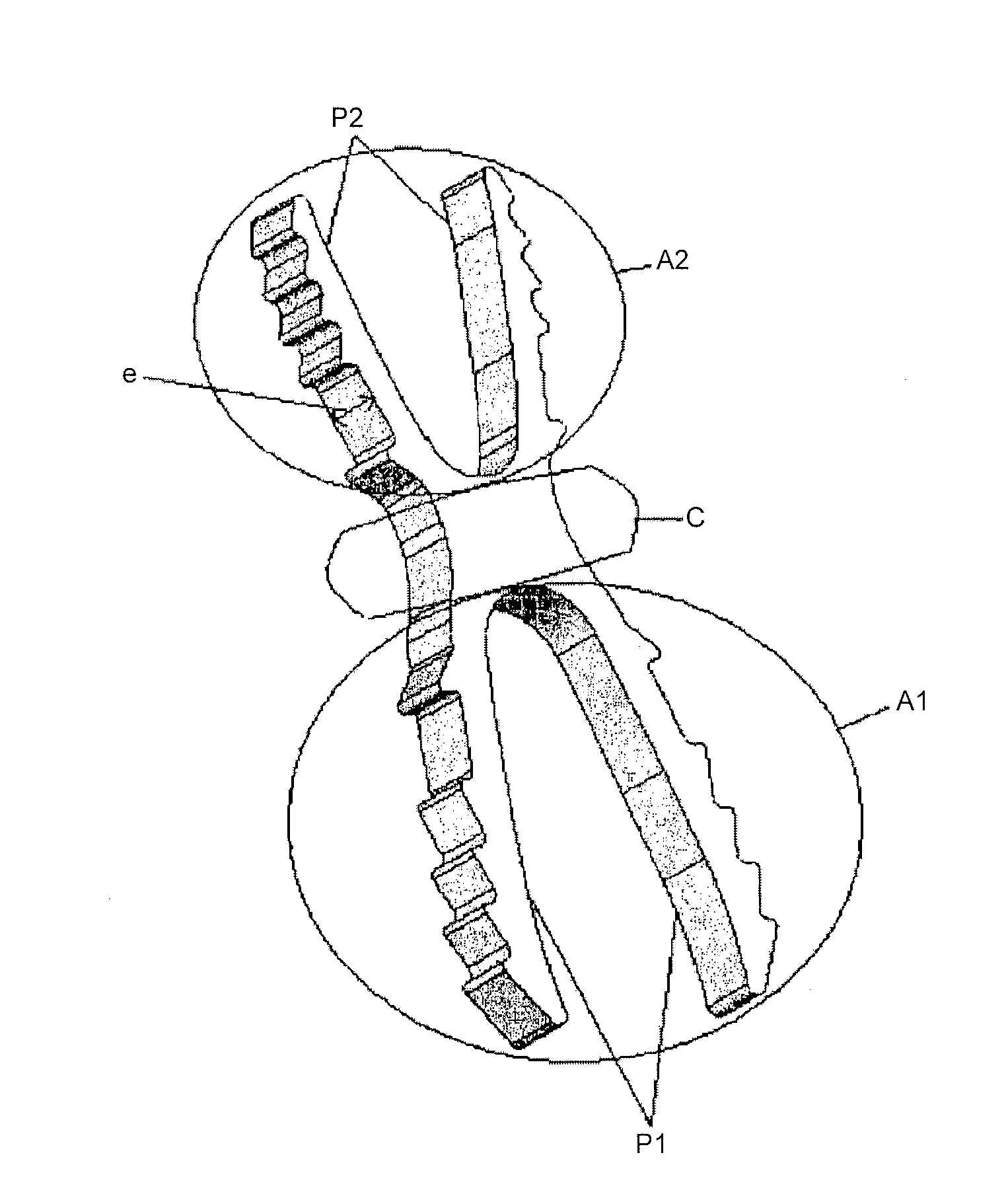 Osteosynthesis device