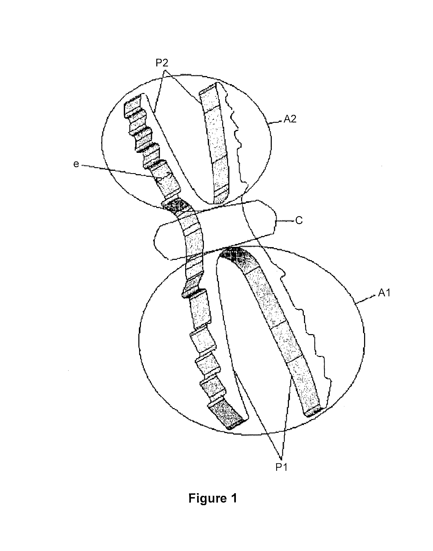 Osteosynthesis device