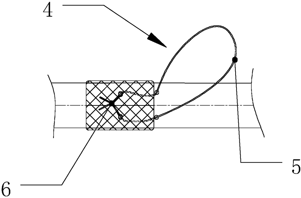 Middle digestive tract implanted tube instrument and rapid implantation method thereof