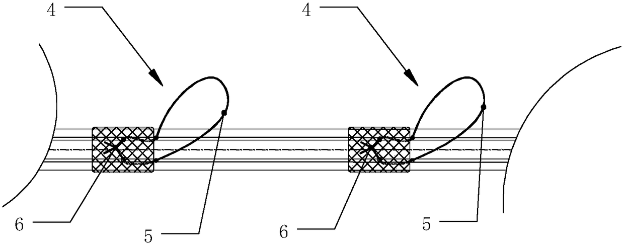 Middle digestive tract implanted tube instrument and rapid implantation method thereof