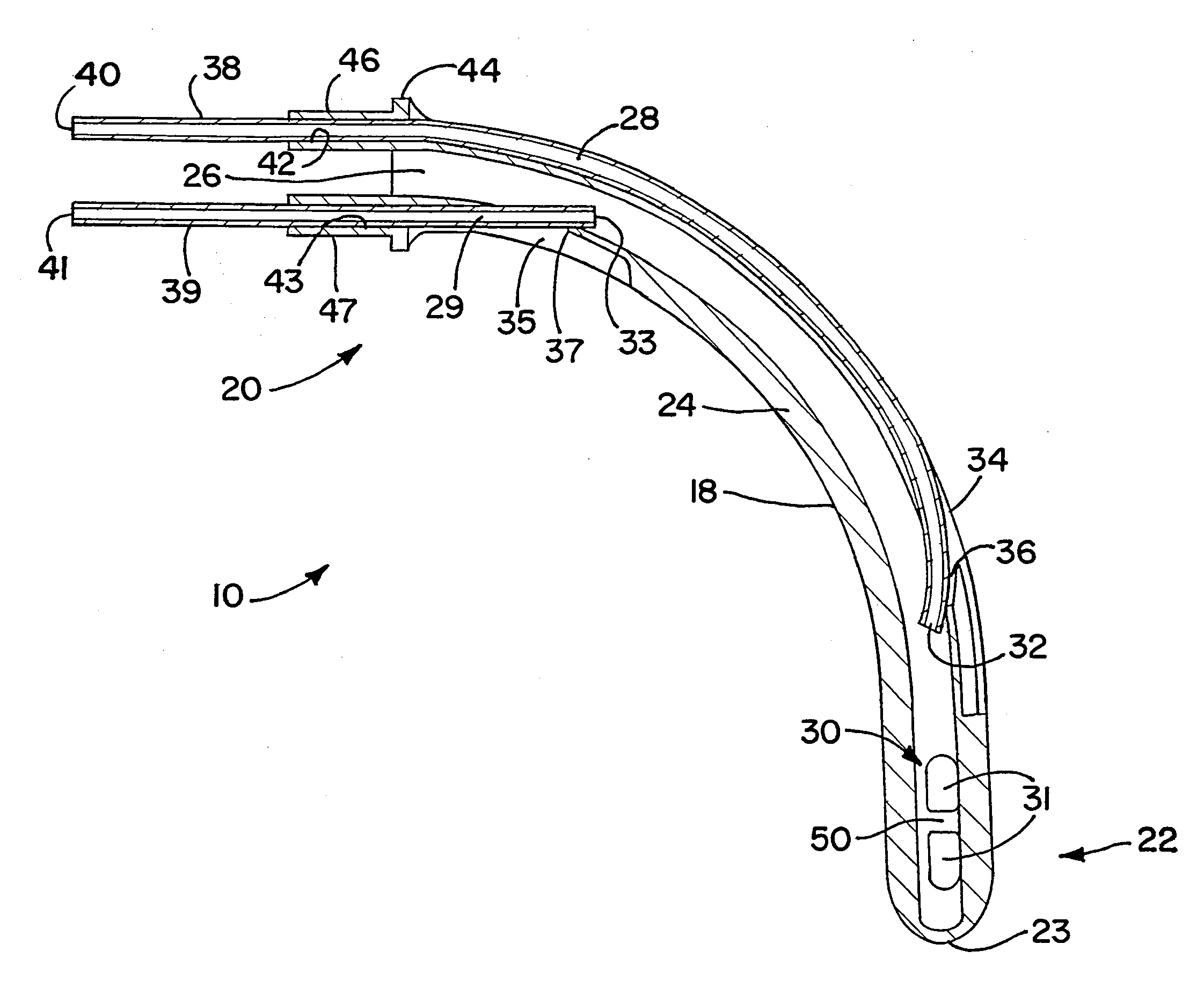 Nasopharyngeal airway