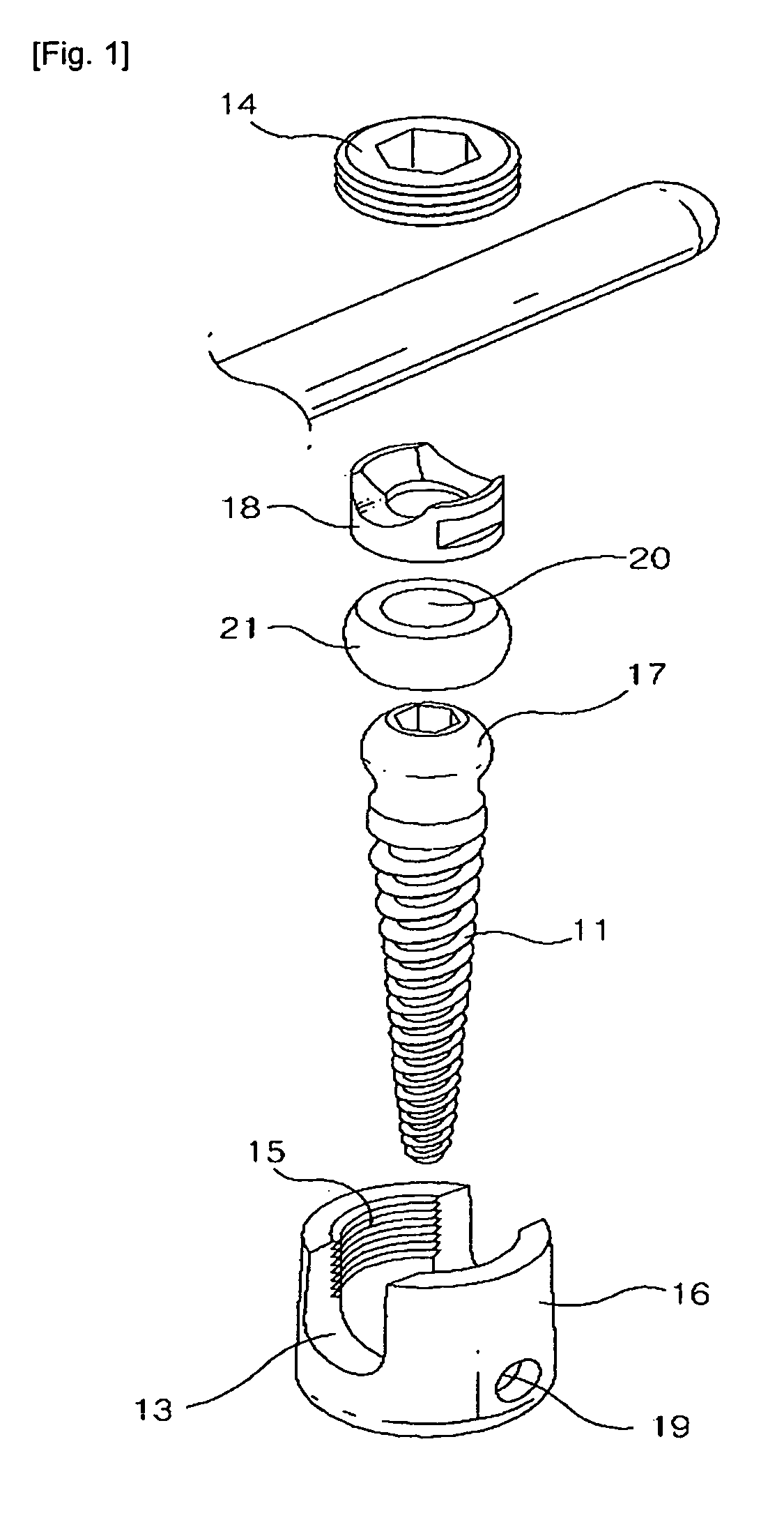 Buffer type vertebral pedicle screw