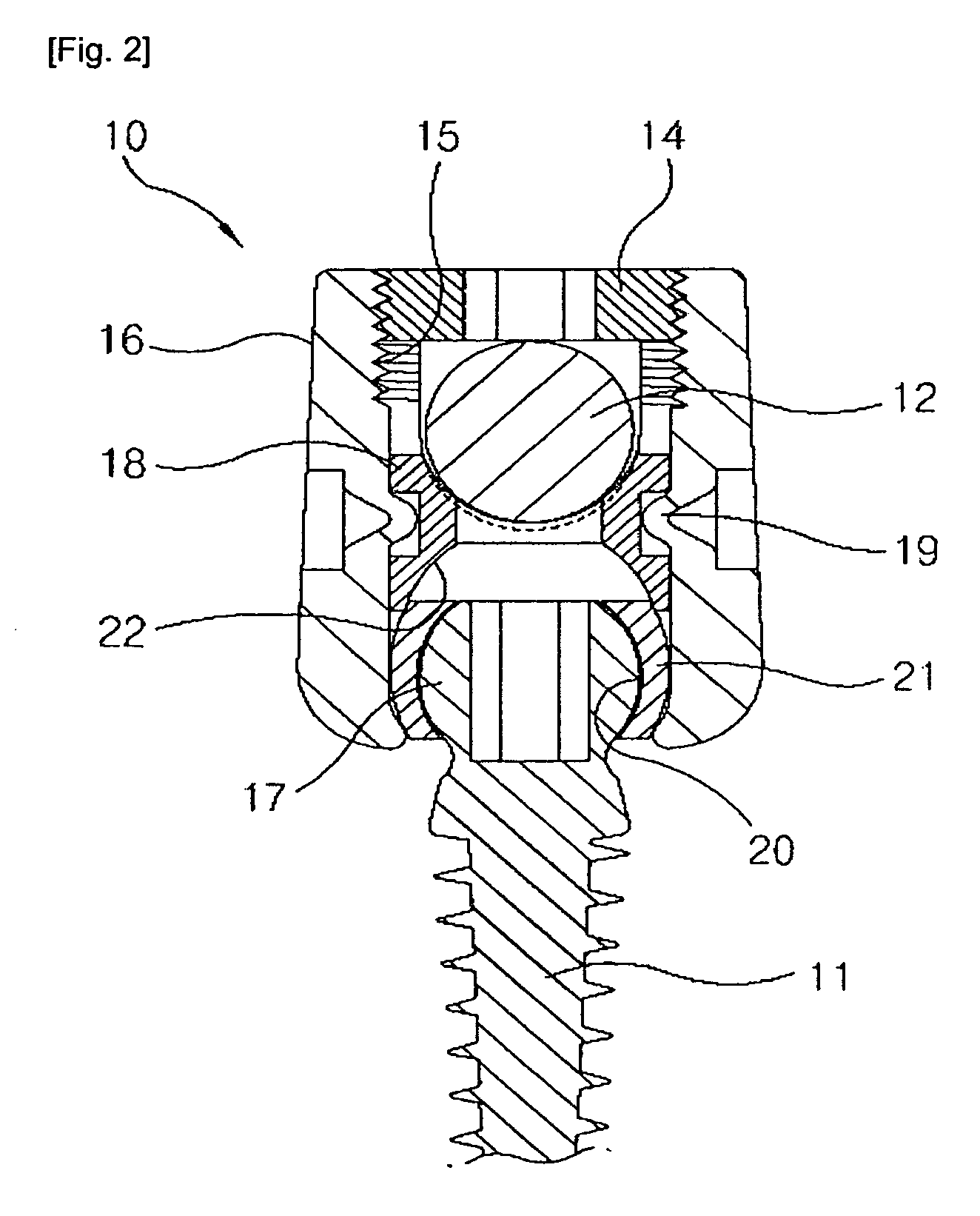 Buffer type vertebral pedicle screw