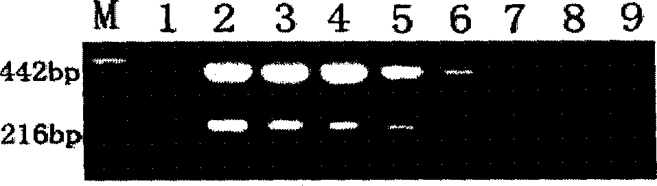 Watermelon anthrax bacteria detecting kit and its detecting method