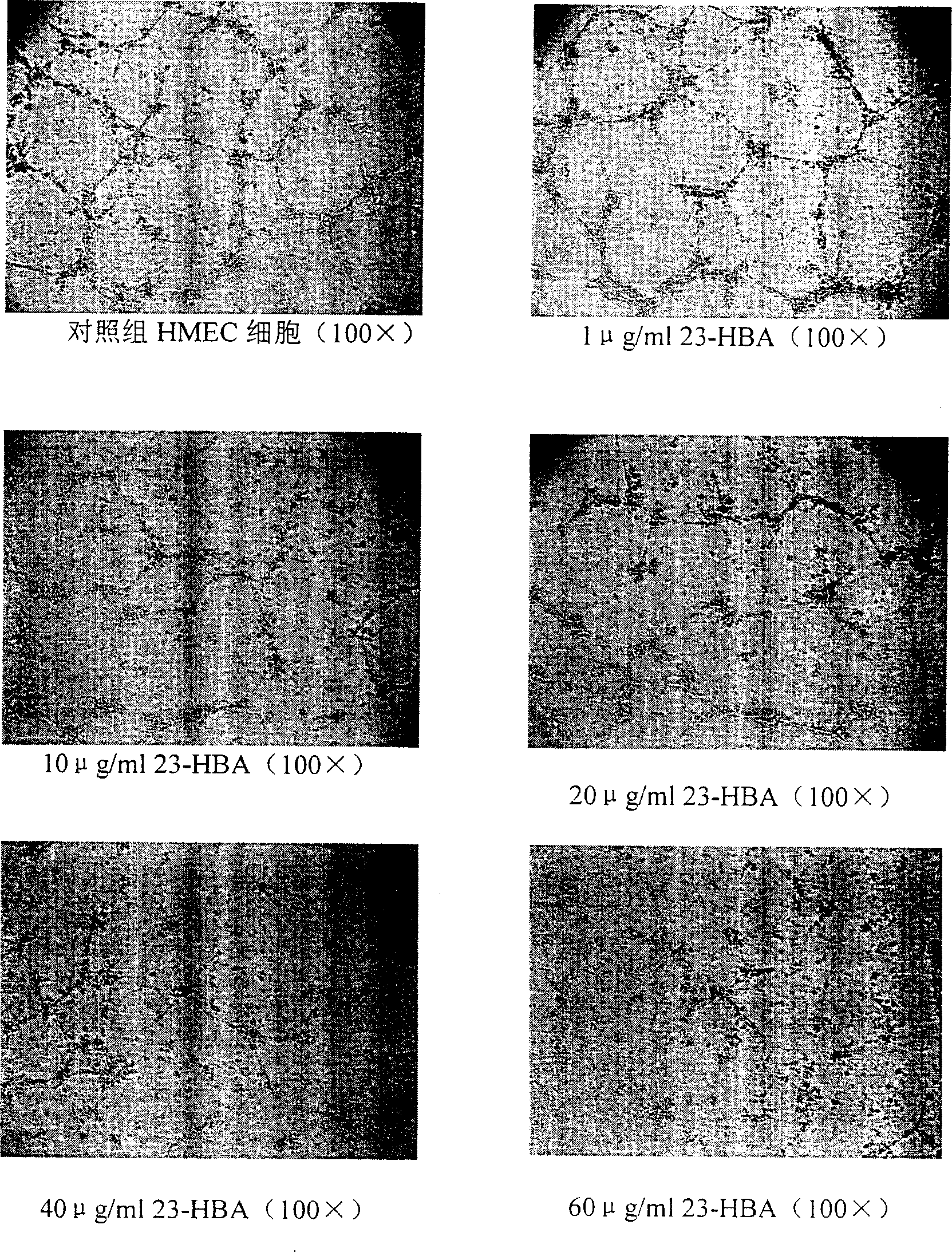 Use of 23-hydroxy betulic acid in preparing administrative and/or preventive drugs for inhibiting blood vessel formation