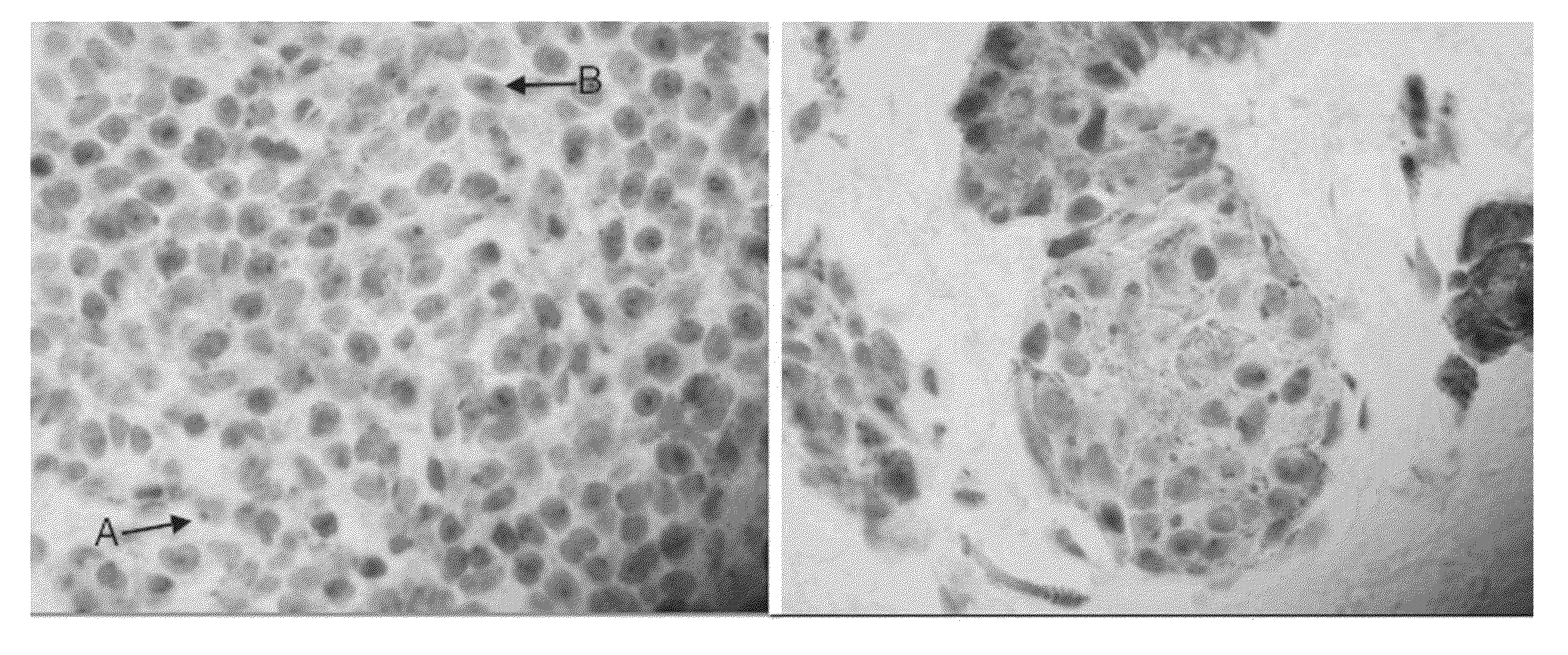 Method for diagnosing melanocytic proliferations