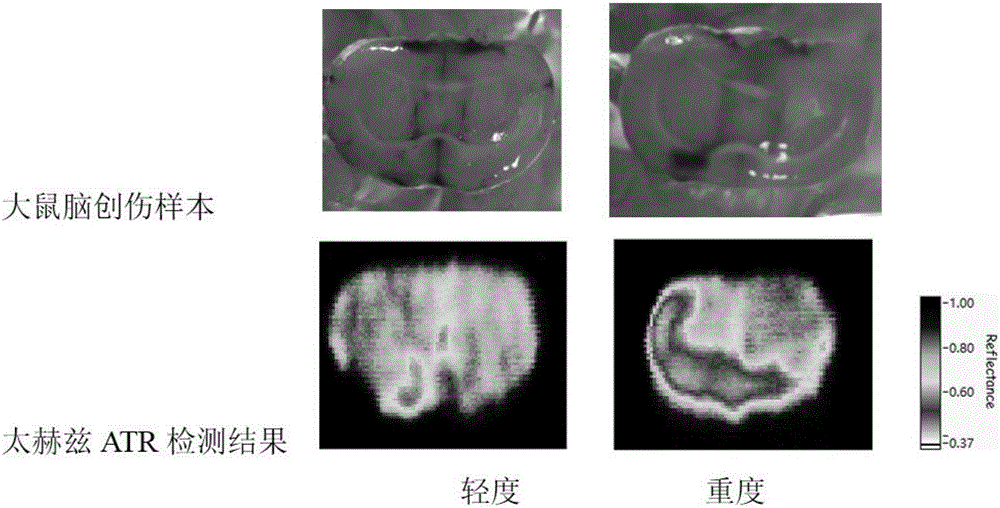 Terahertz wave attenuation total reflection imaging-based cerebral trauma tissue detection device