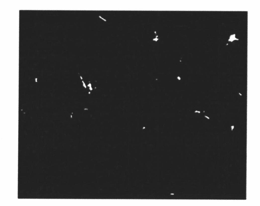 Method for detecting mycobacterium tuberculosis by in-situ fluorescent loop-mediated isothermal nucleic acid amplification technology and kit