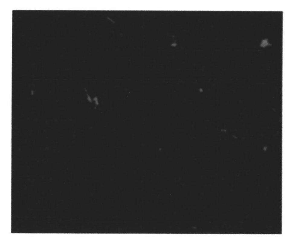 Method for detecting mycobacterium tuberculosis by in-situ fluorescent loop-mediated isothermal nucleic acid amplification technology and kit