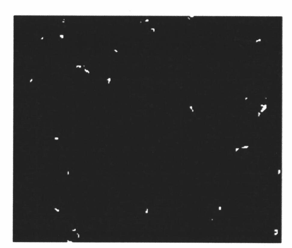 Method for detecting mycobacterium tuberculosis by in-situ fluorescent loop-mediated isothermal nucleic acid amplification technology and kit