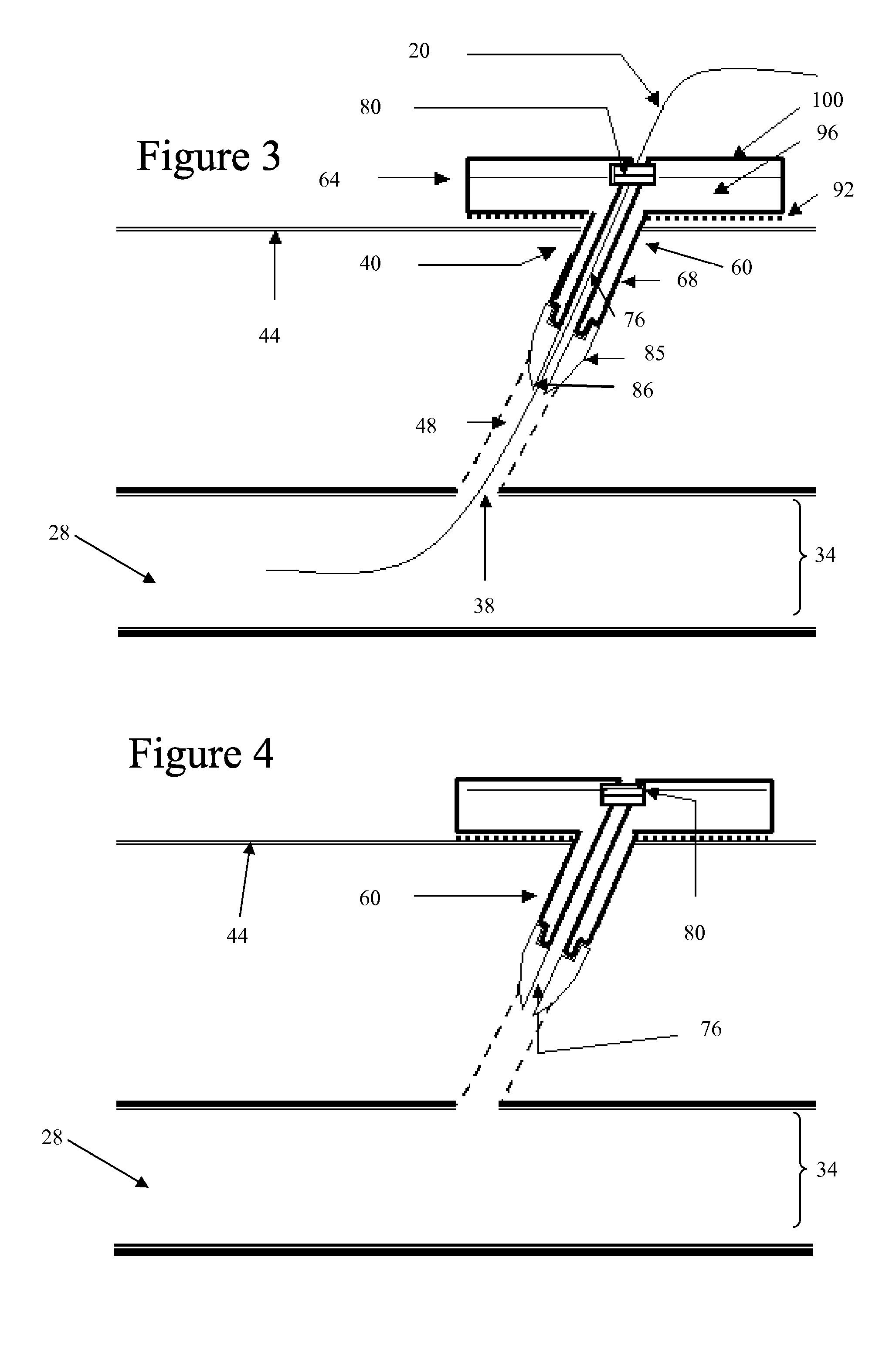 Hemostatic bandage and method of use