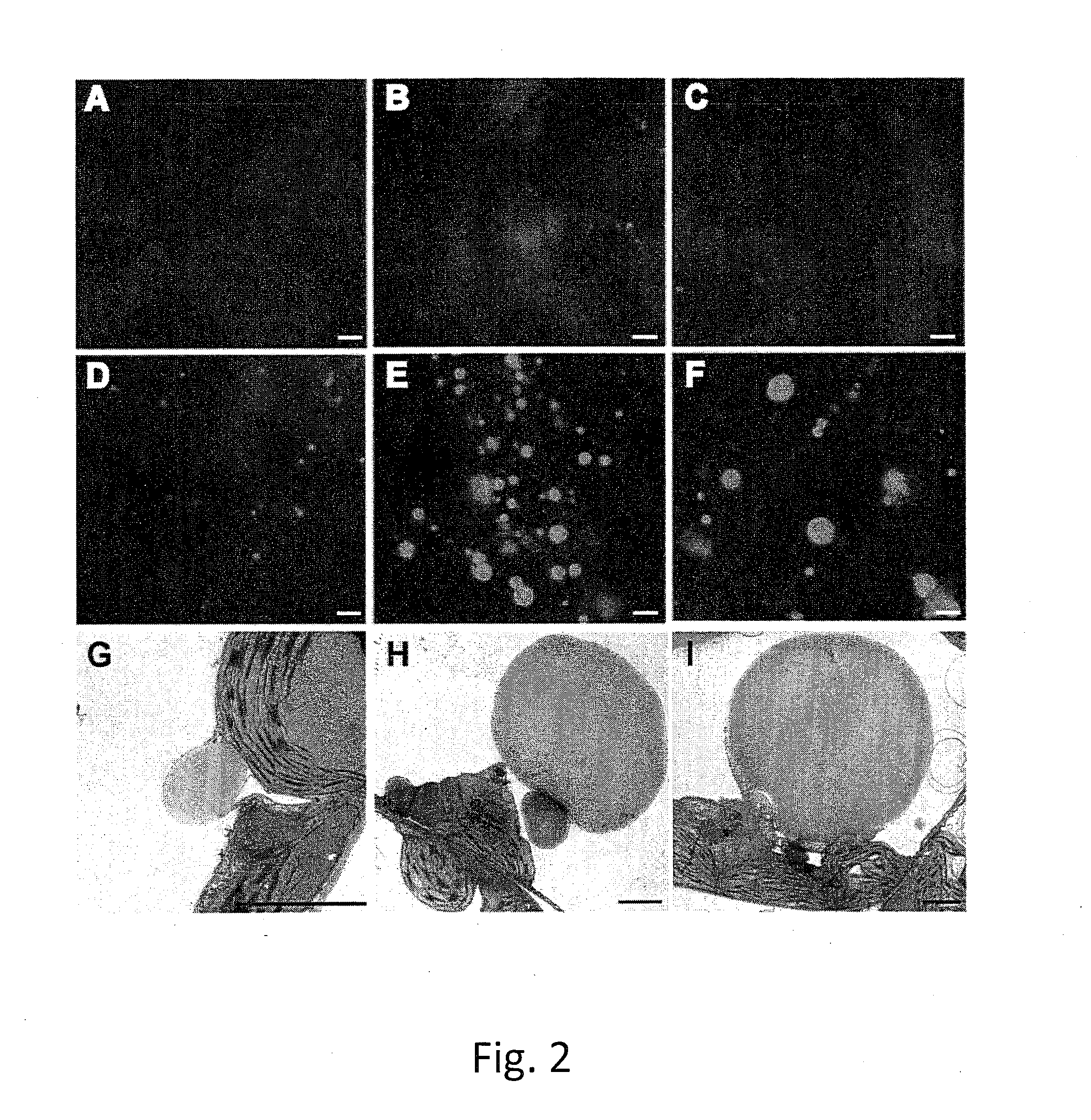 Enhanced Triacylglycerol Accumulation in Vegetative Tissues of Plants