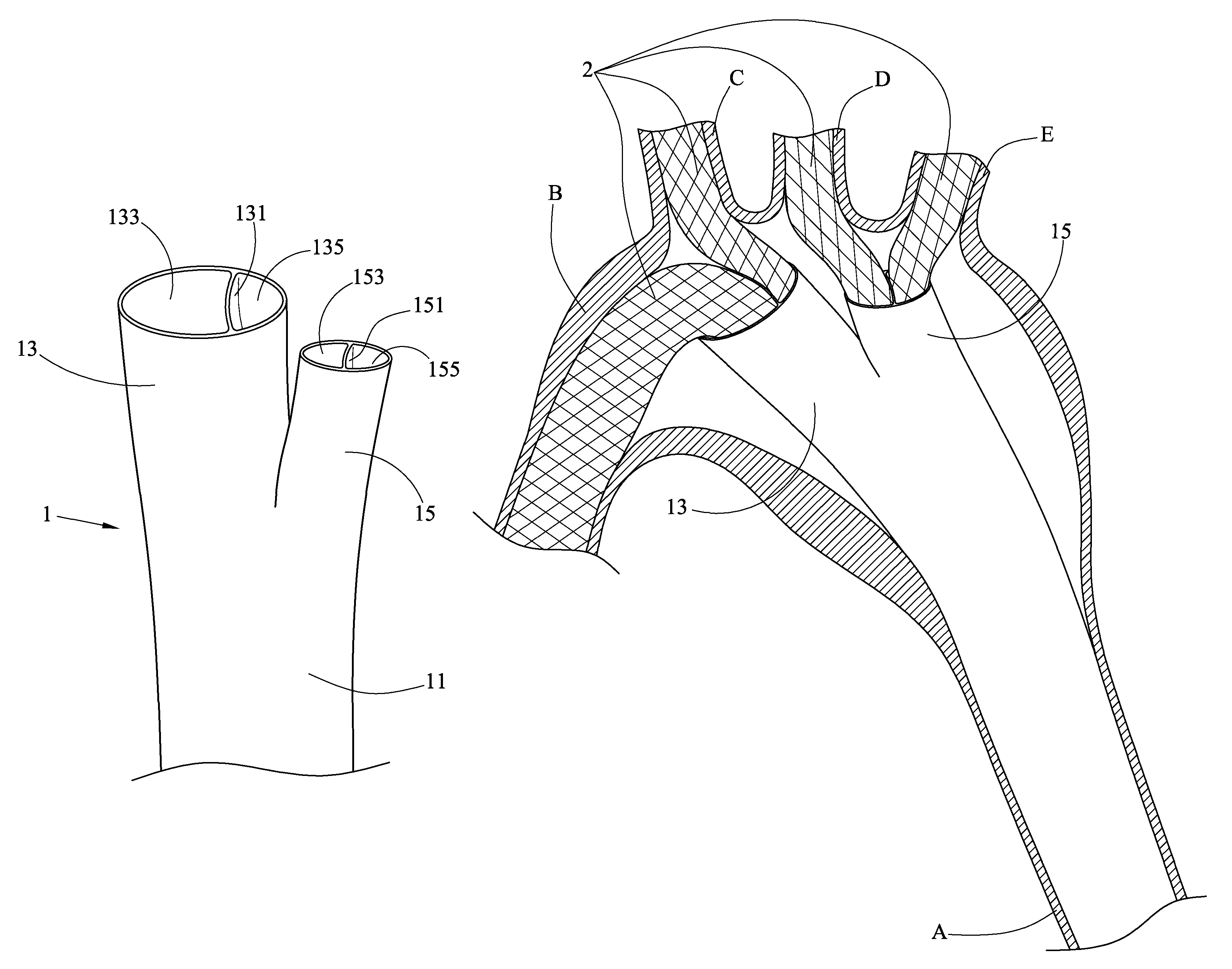 Method of implanting an aortic stent