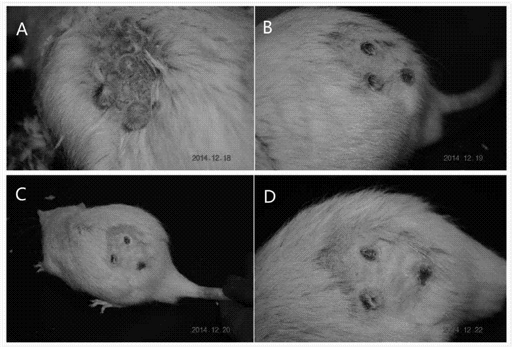 Annular elastic ring for medical loop ligation device