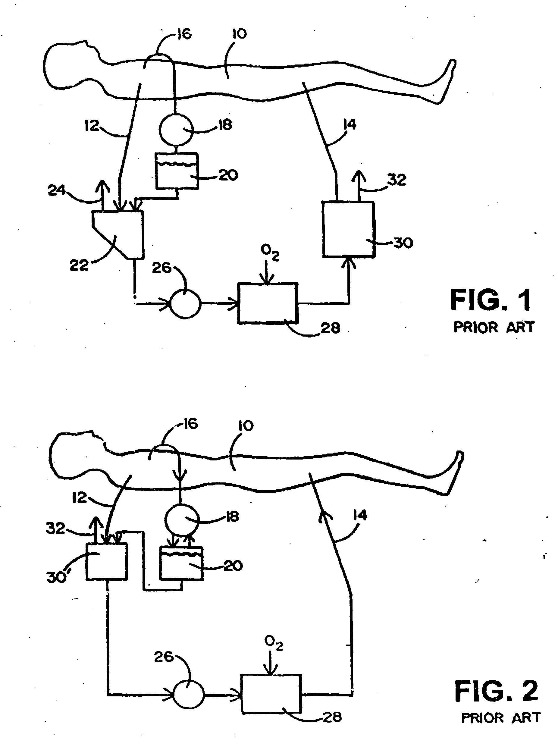 Disposable, integrated, extracorporeal blood circuit