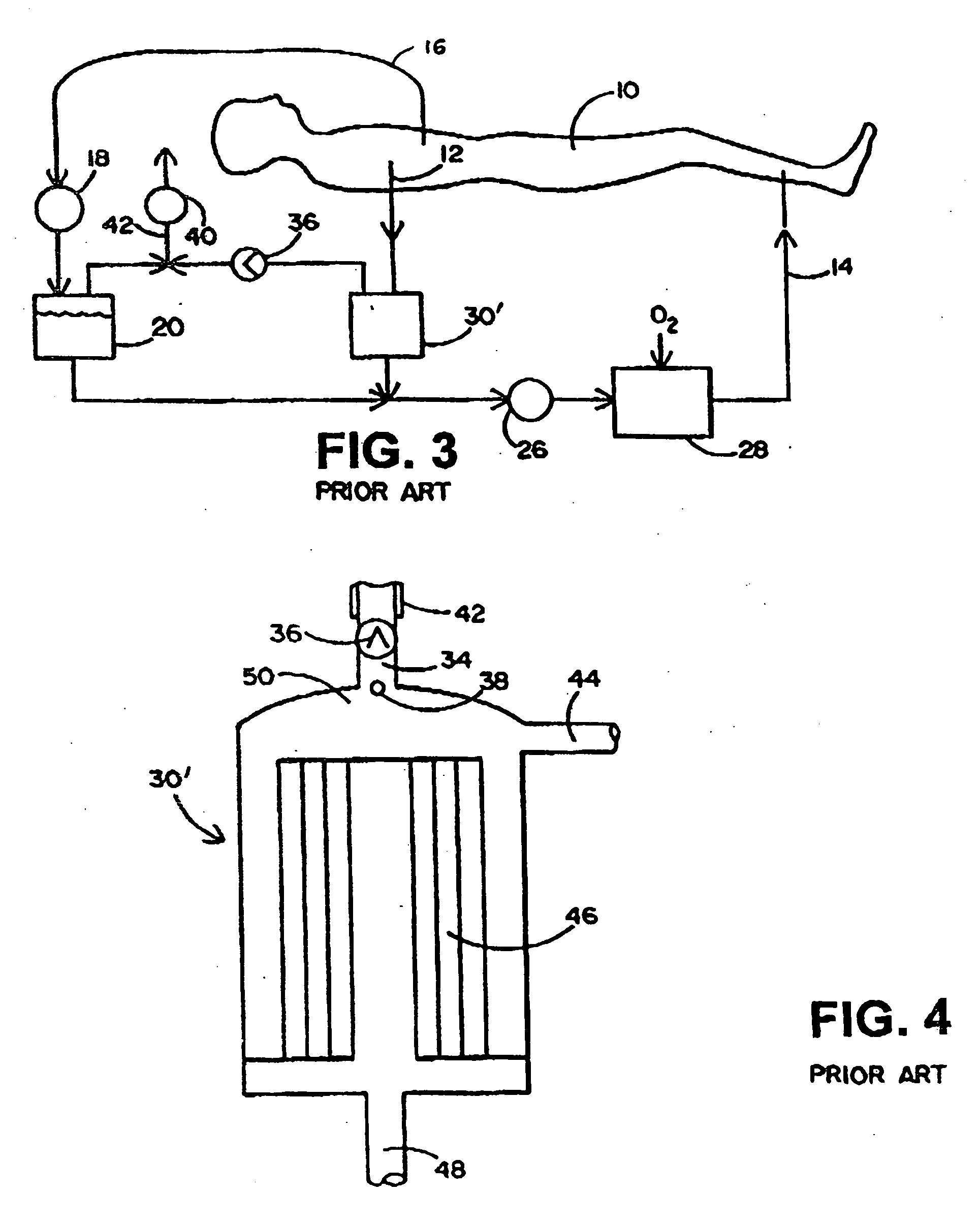 Disposable, integrated, extracorporeal blood circuit