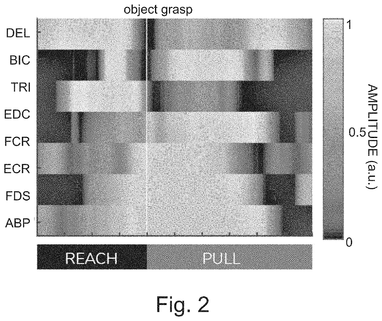 System for providing neuromodulation, especially neurostimulation