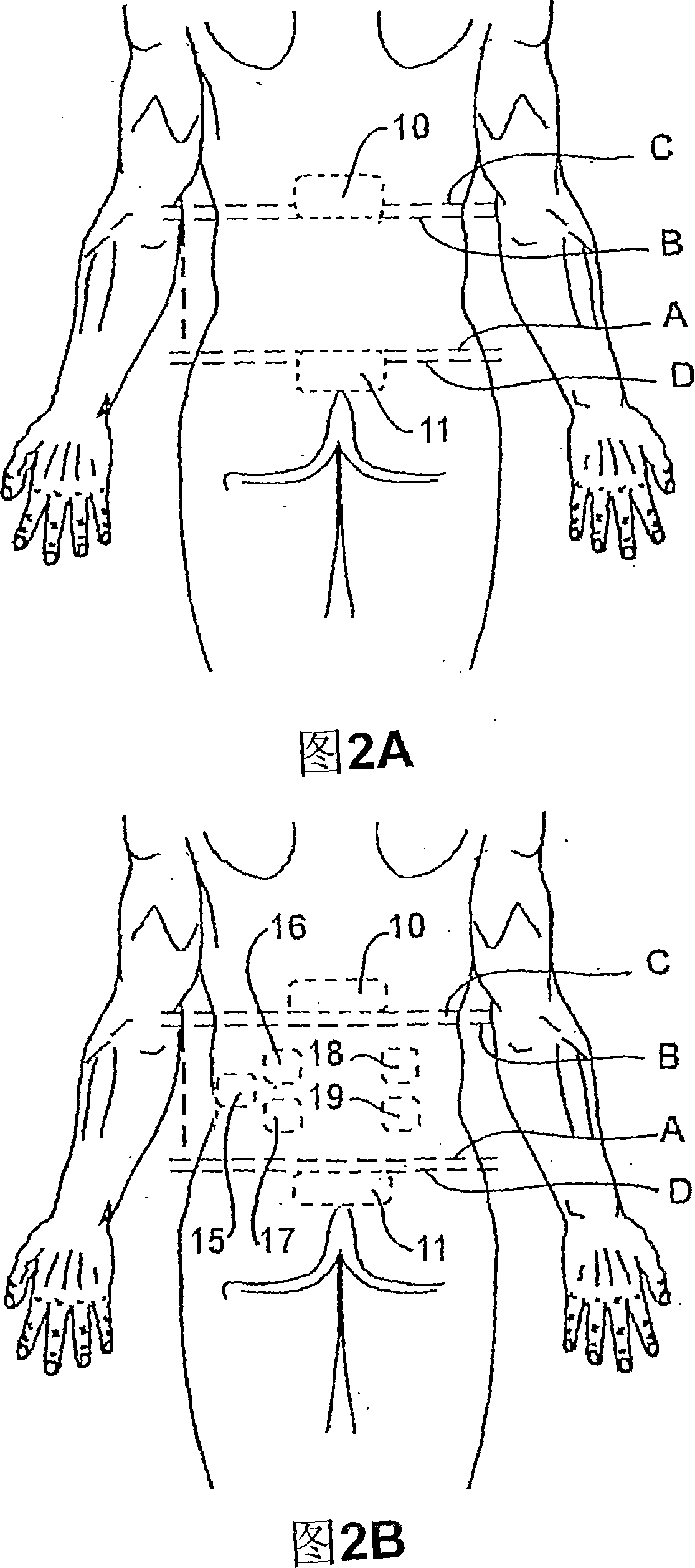 Apparatus and method for monitoring strain and/or load applied to a mammal