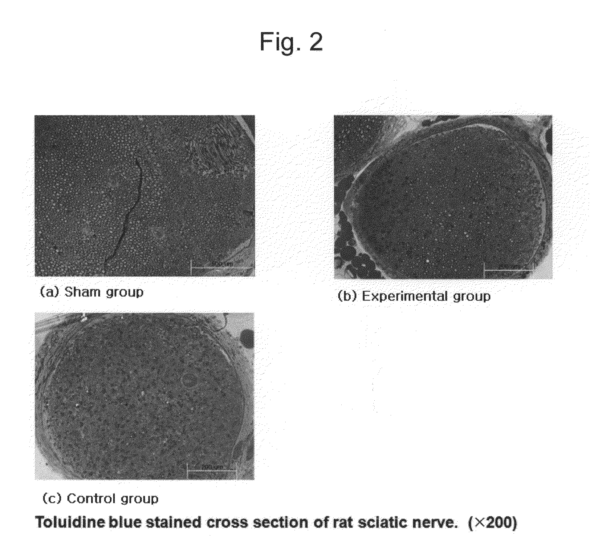 Agent comprising g-csf for treatment of traumatic peripheral nerve injury and method for treating traumatic peripheral nerve injury with the same