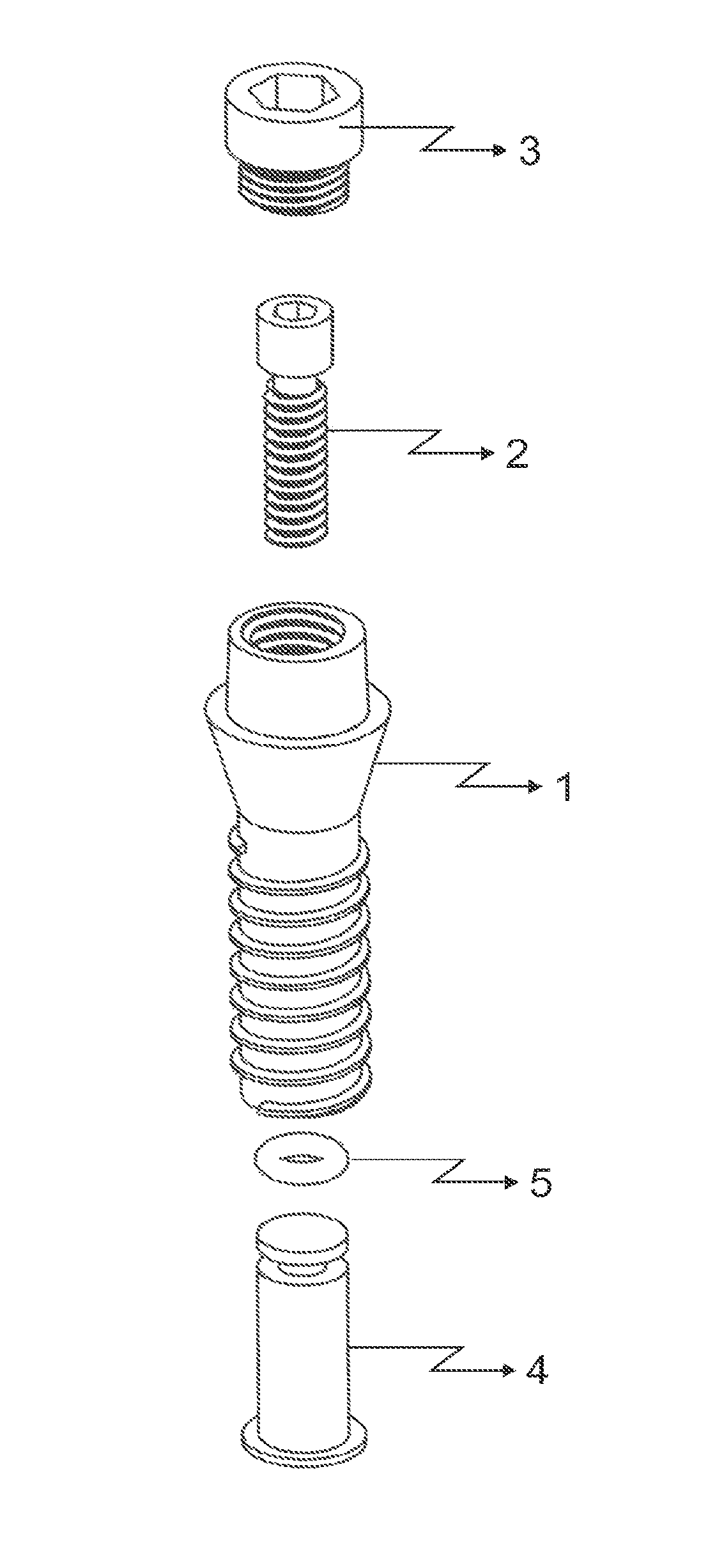 Dental implant that increases bone support