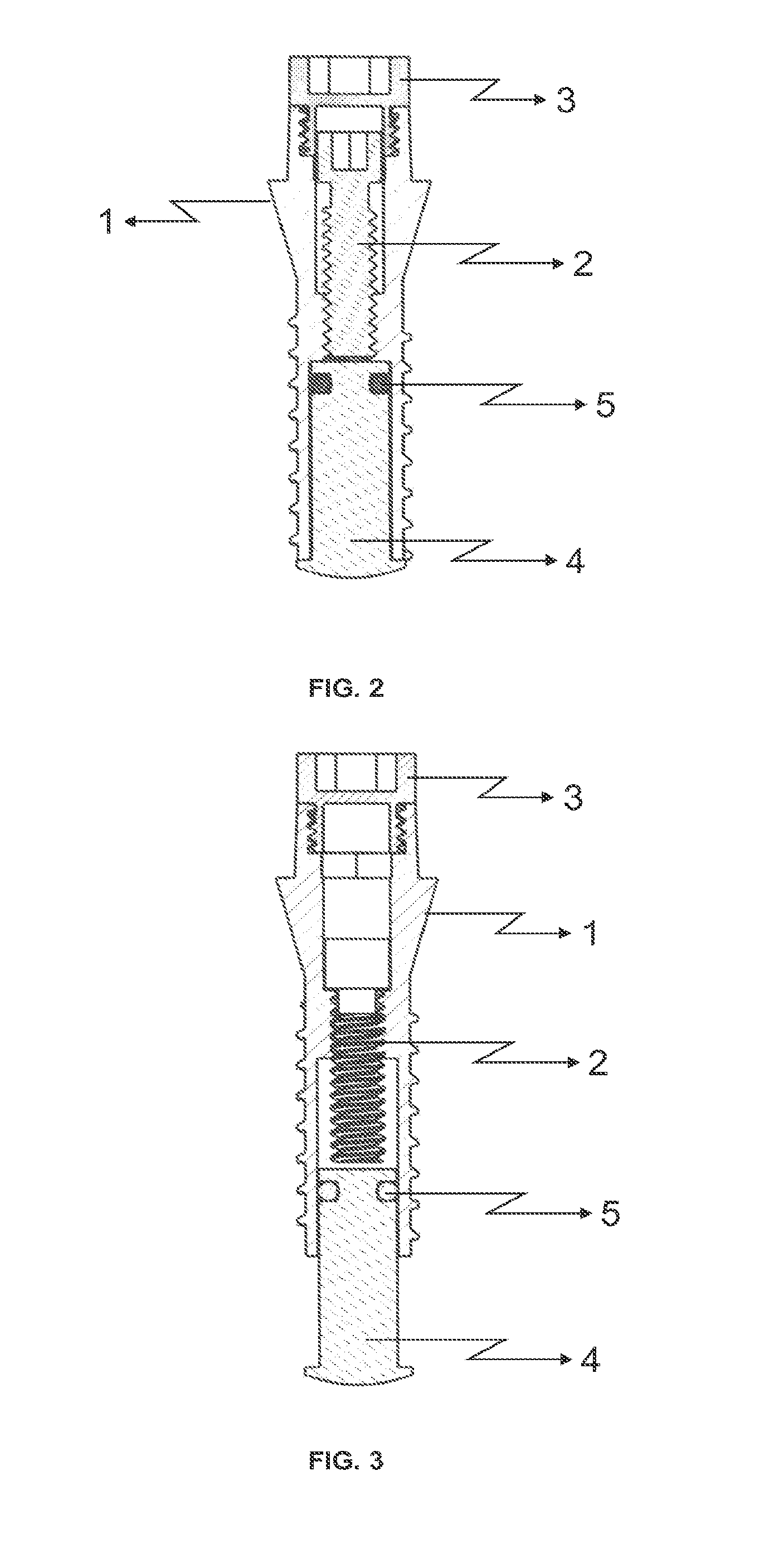 Dental implant that increases bone support