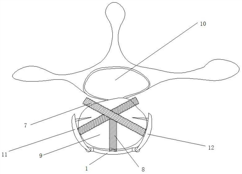 An oblique transverse fixation plate for anterior cervical spine