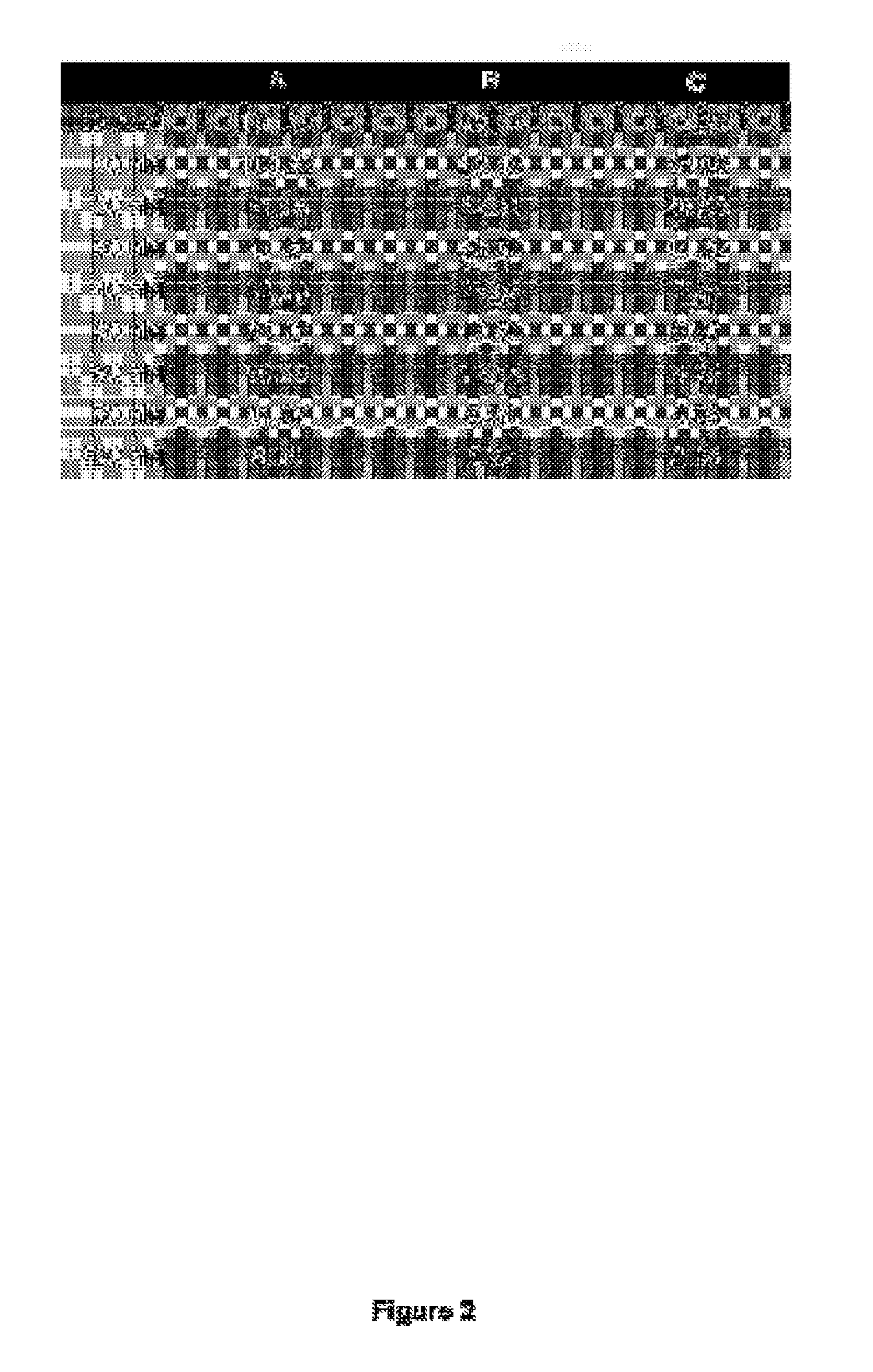 Boosting the effect of methotrexate through the combined use with lipophilic statins