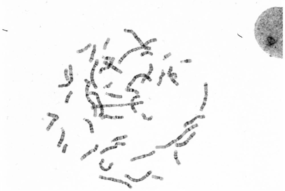 Deep learning-based karyotype analysis method and system