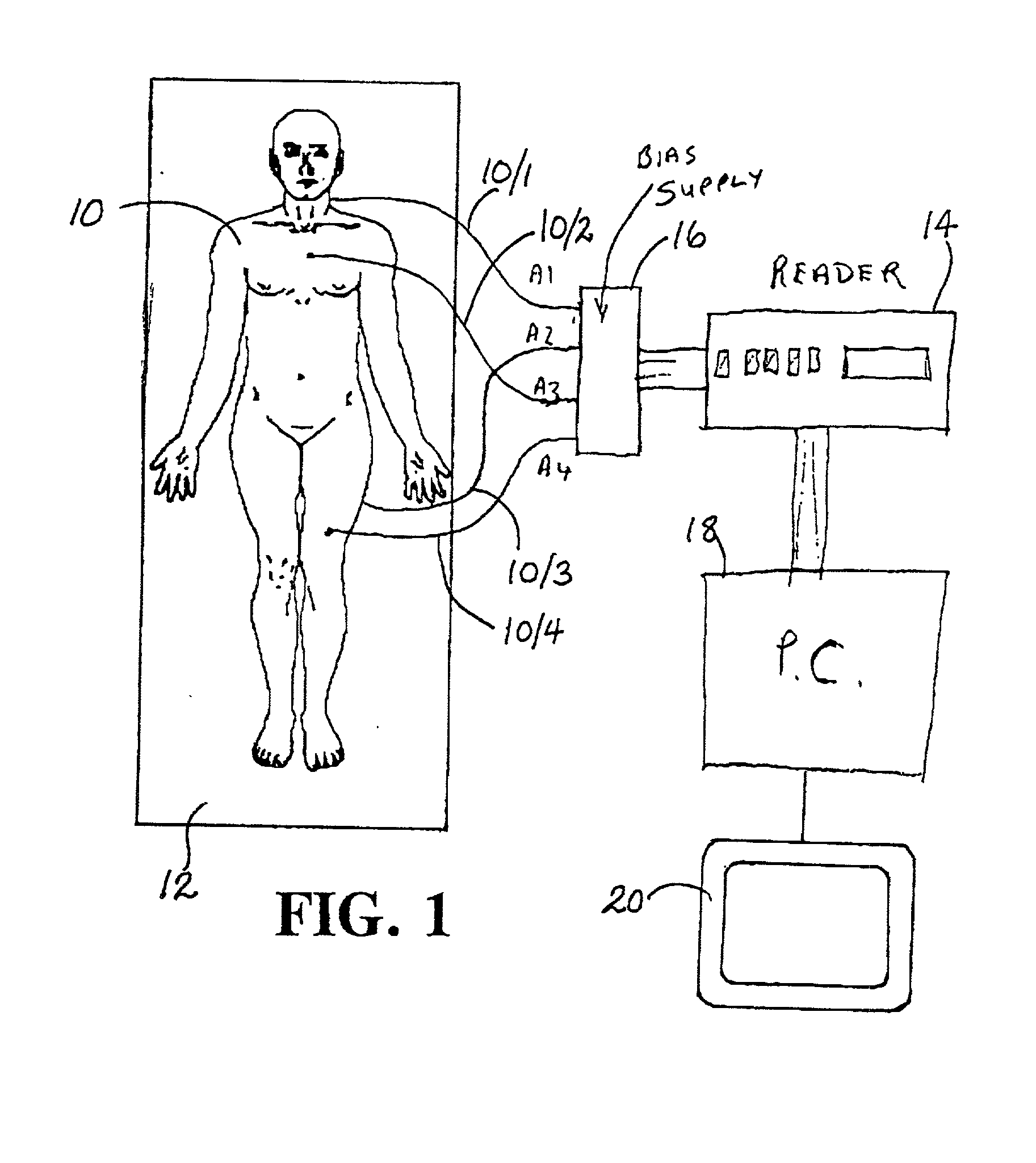 Computer assisted radiotherapy dosimeter system and a method therefor