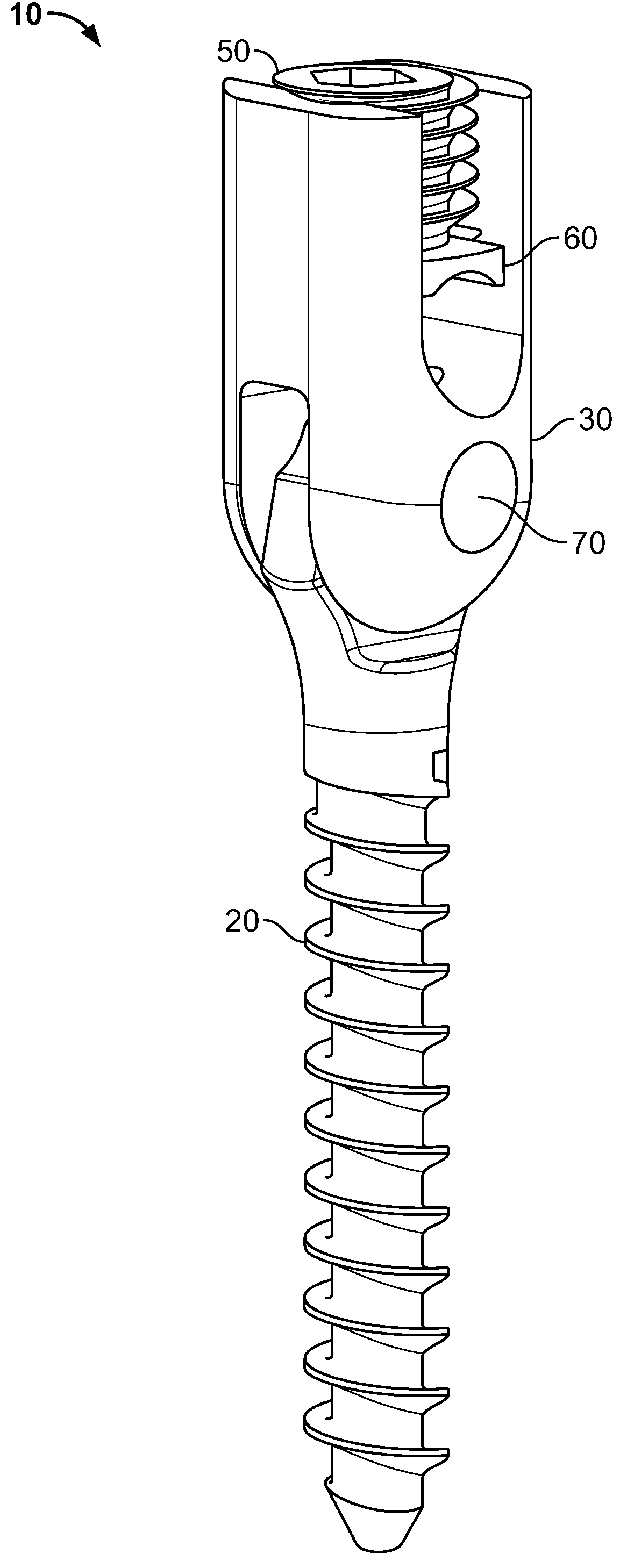 Mono-Planar Pedicle Screw Method, System and Kit