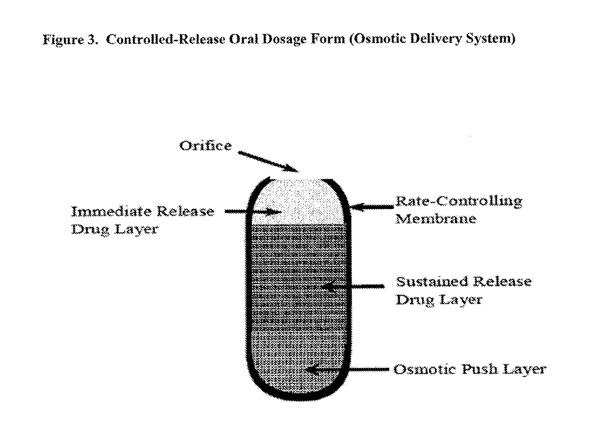 Controlled release of N-acetylcysteine (NAC) for reduction of systemic and/or vascular inflammation