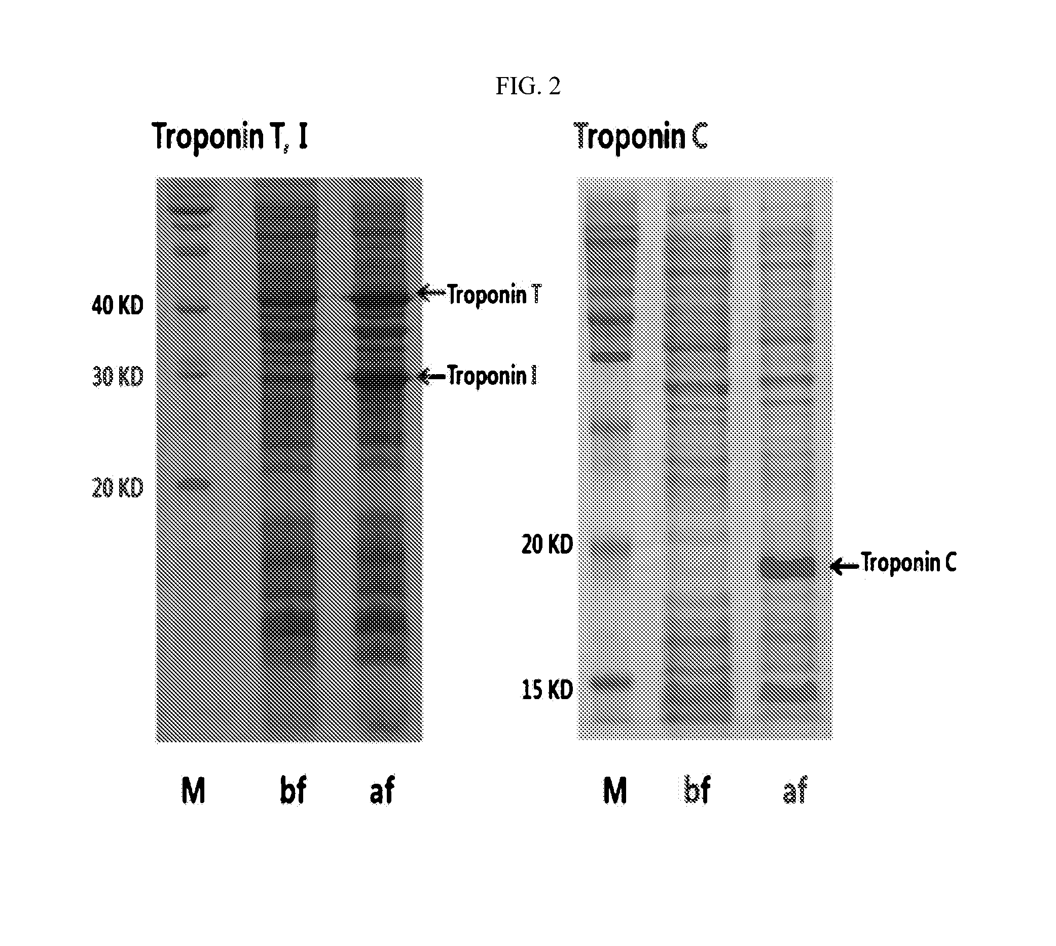 DNA aptamer specifically binding to human cardiac troponin i