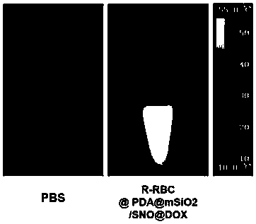 Preparation and application of light-triggered erythrocyte membrane wrapped NO nano bionic donor material