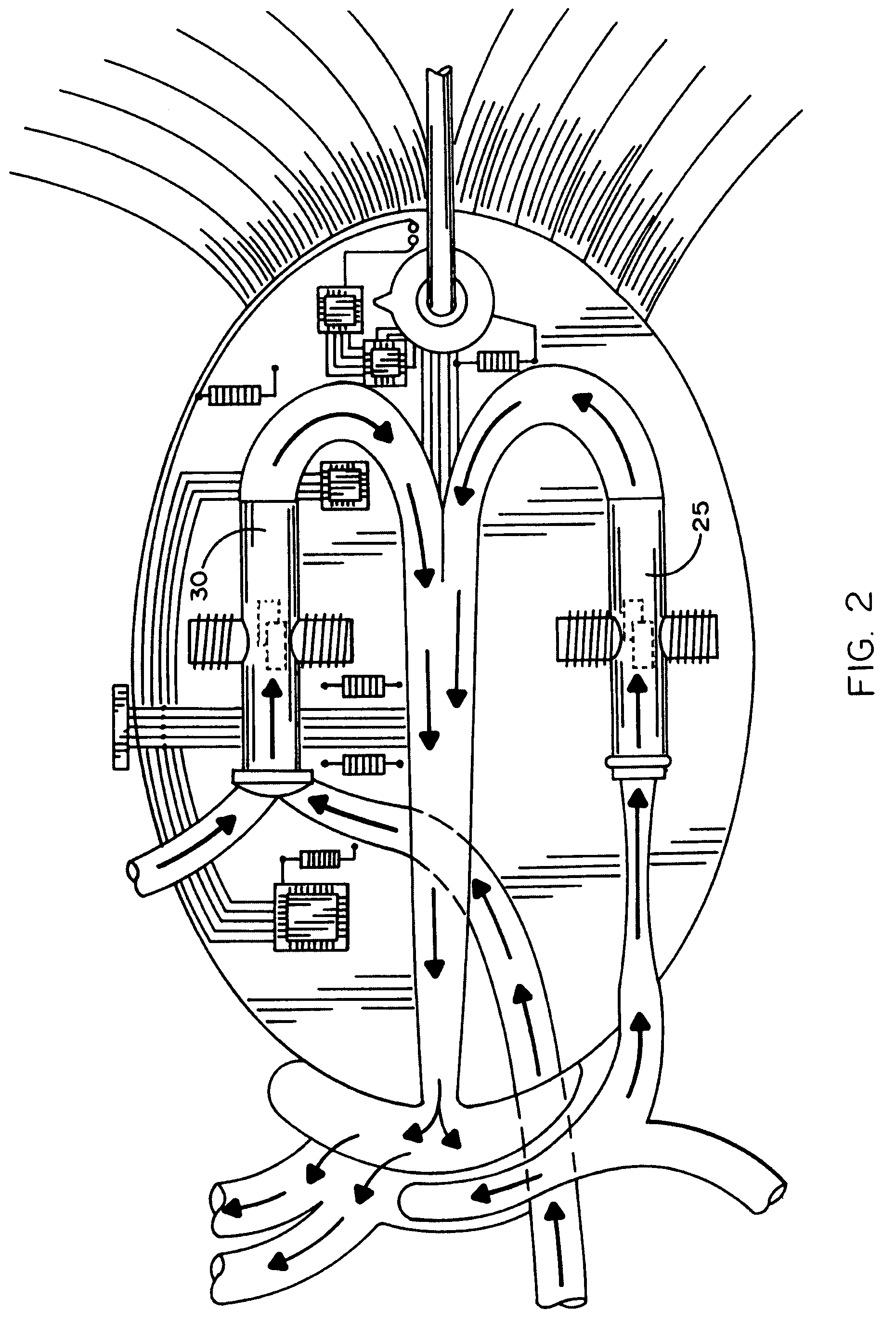 Artificial heart using magnetohydrodynamic propulsionh