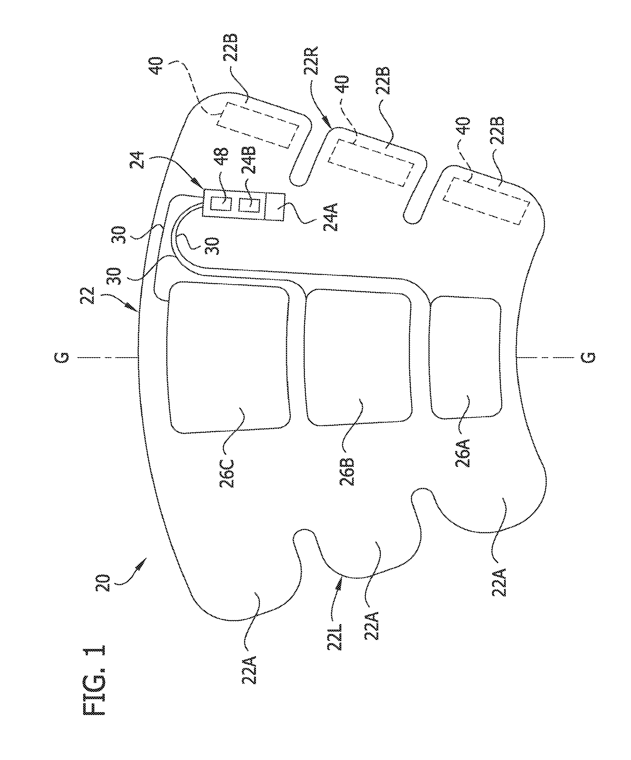 Compression garment apparatus having baseline pressure