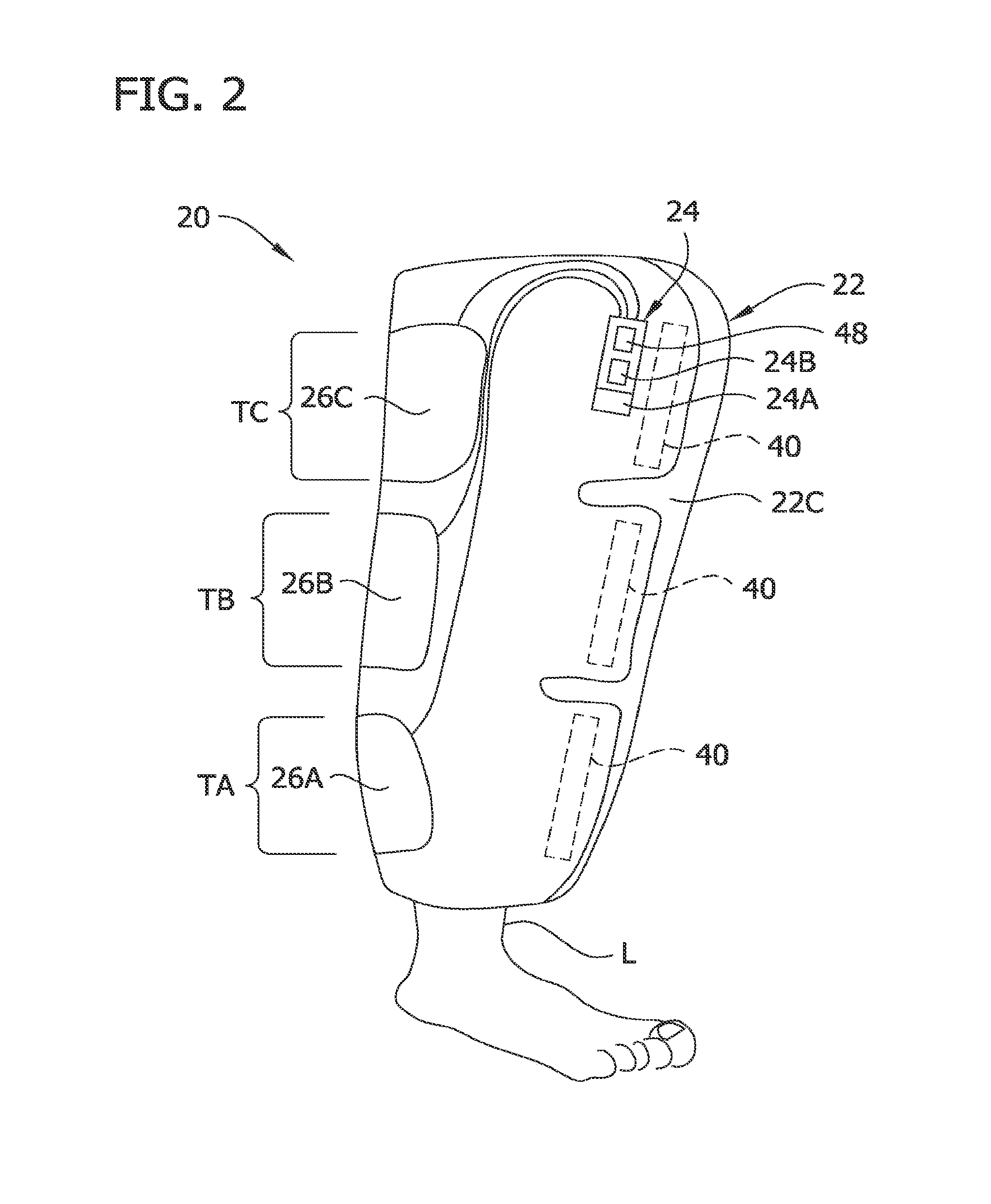 Compression garment apparatus having baseline pressure