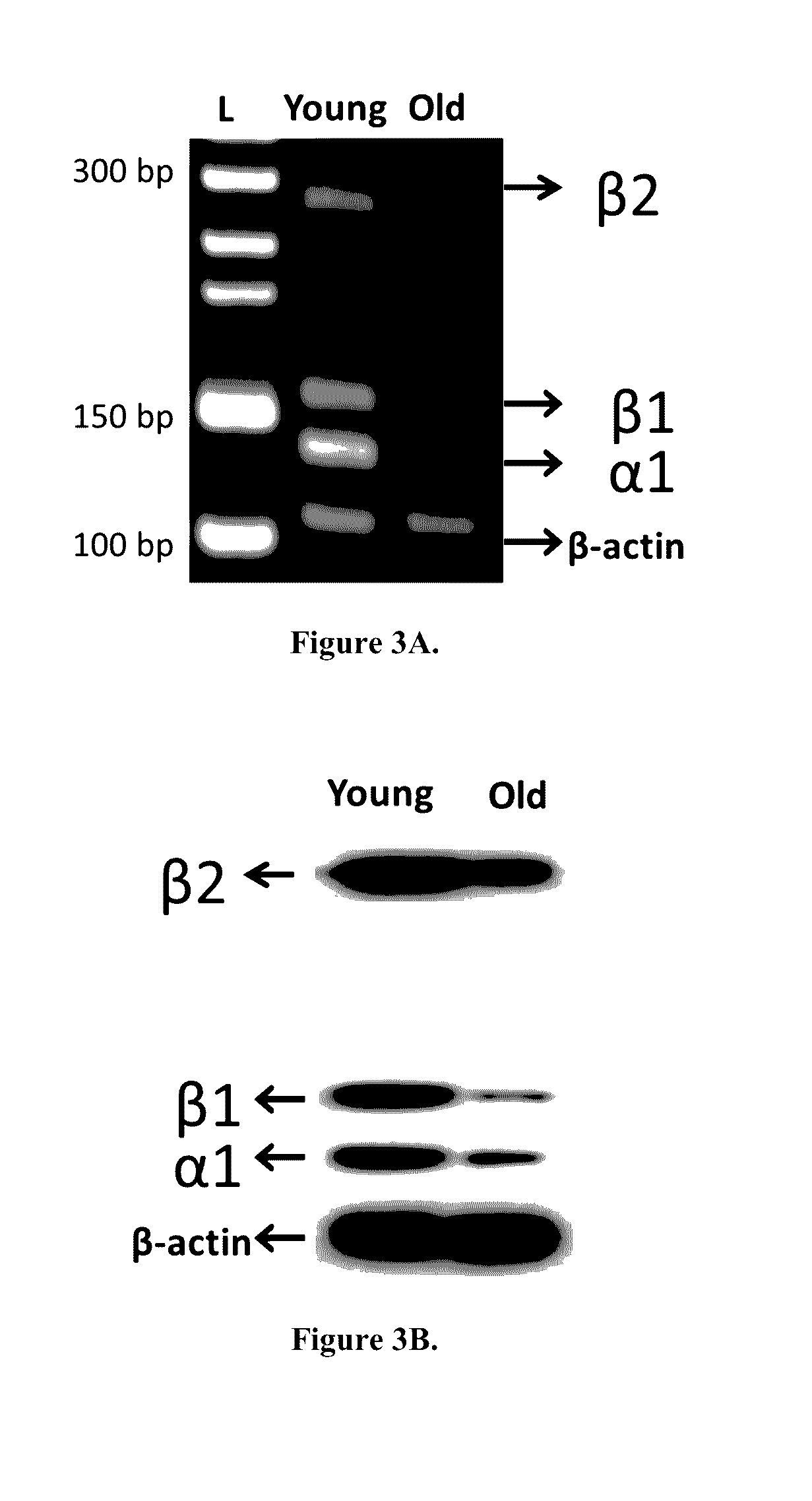 Hormone treatment for age-related hearing loss-presbycusis